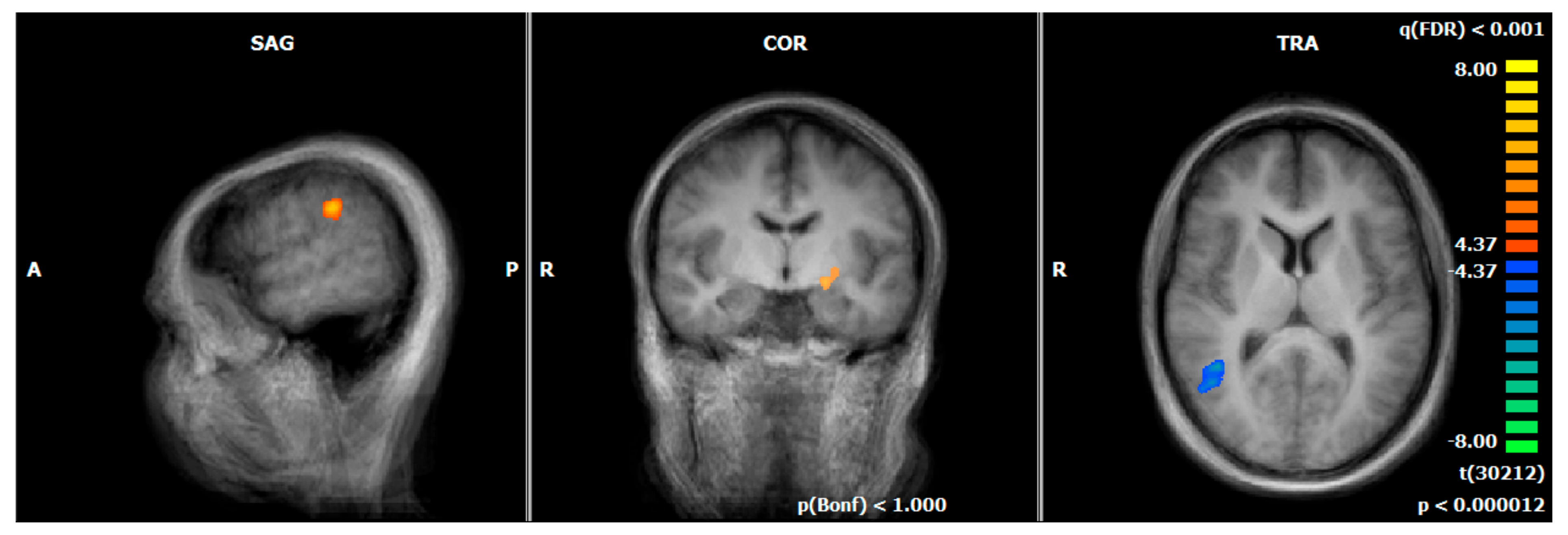 Brainsci 12 01714 g005