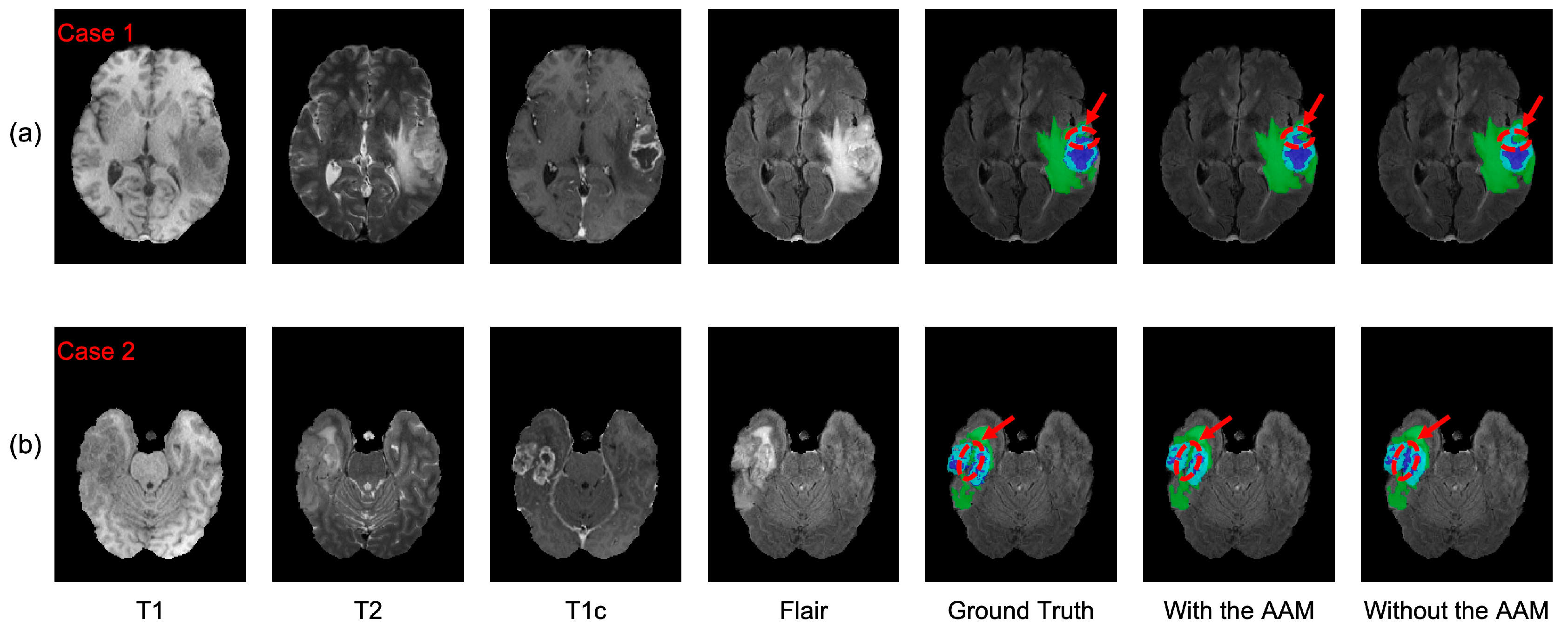 Brainsci 13 00012 g007 Brainsci 13 00012 g007