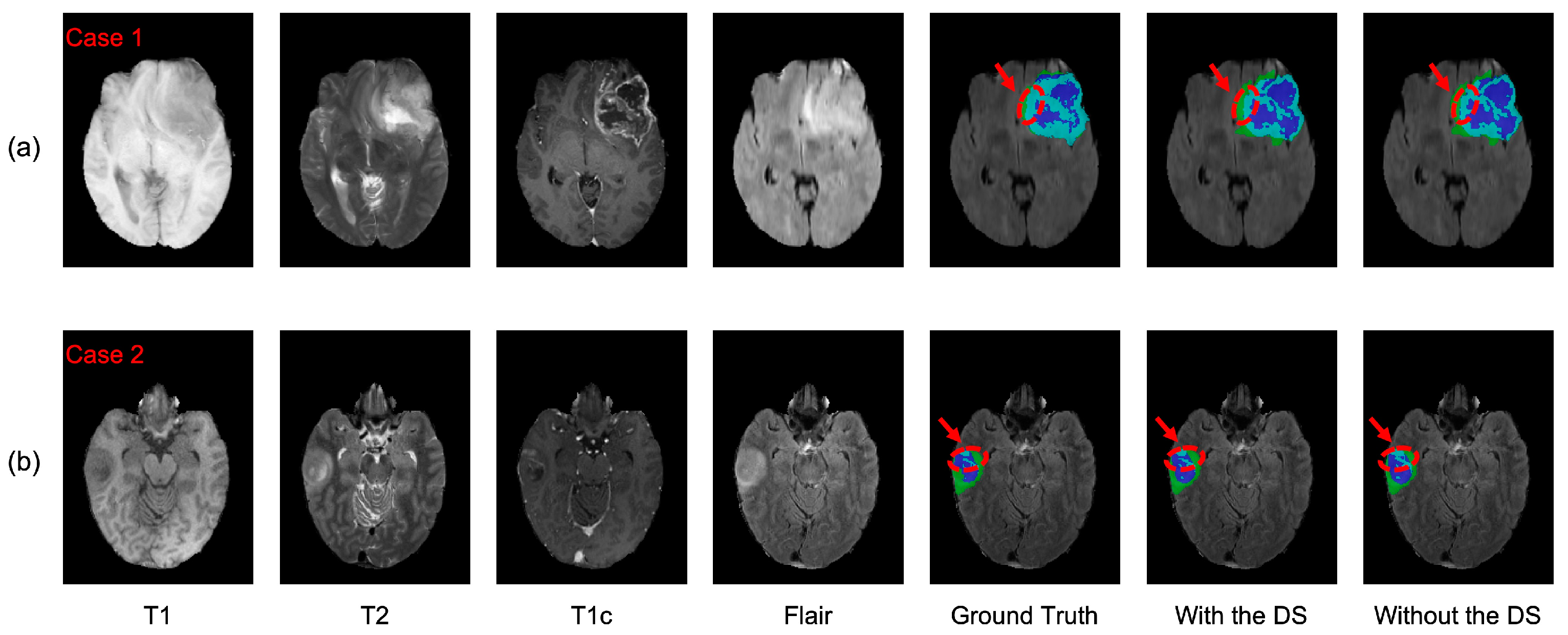 Brainsci 13 00012 g010 Brainsci 13 00012 g010