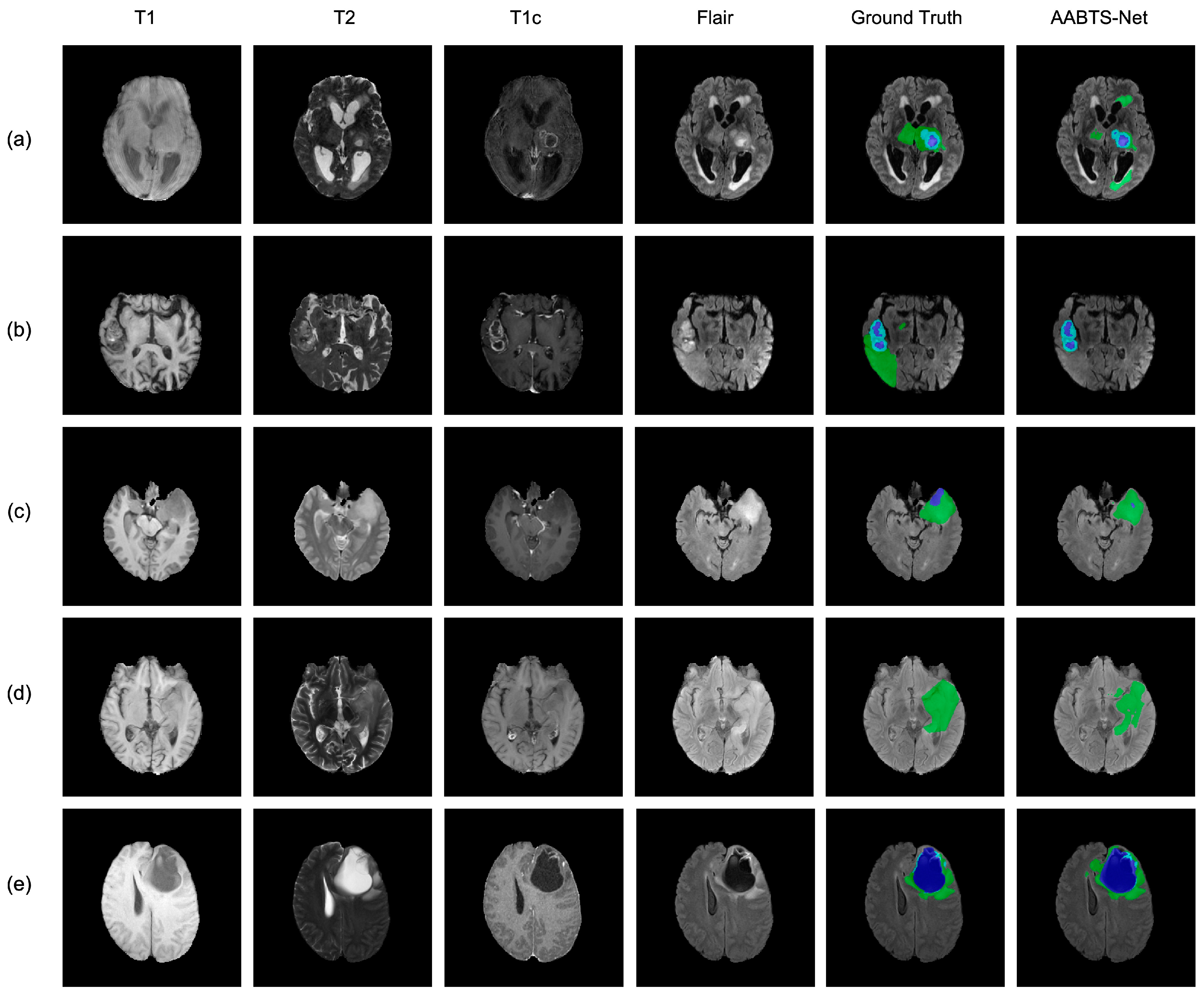 Brainsci 13 00012 g012 Brainsci 13 00012 g012