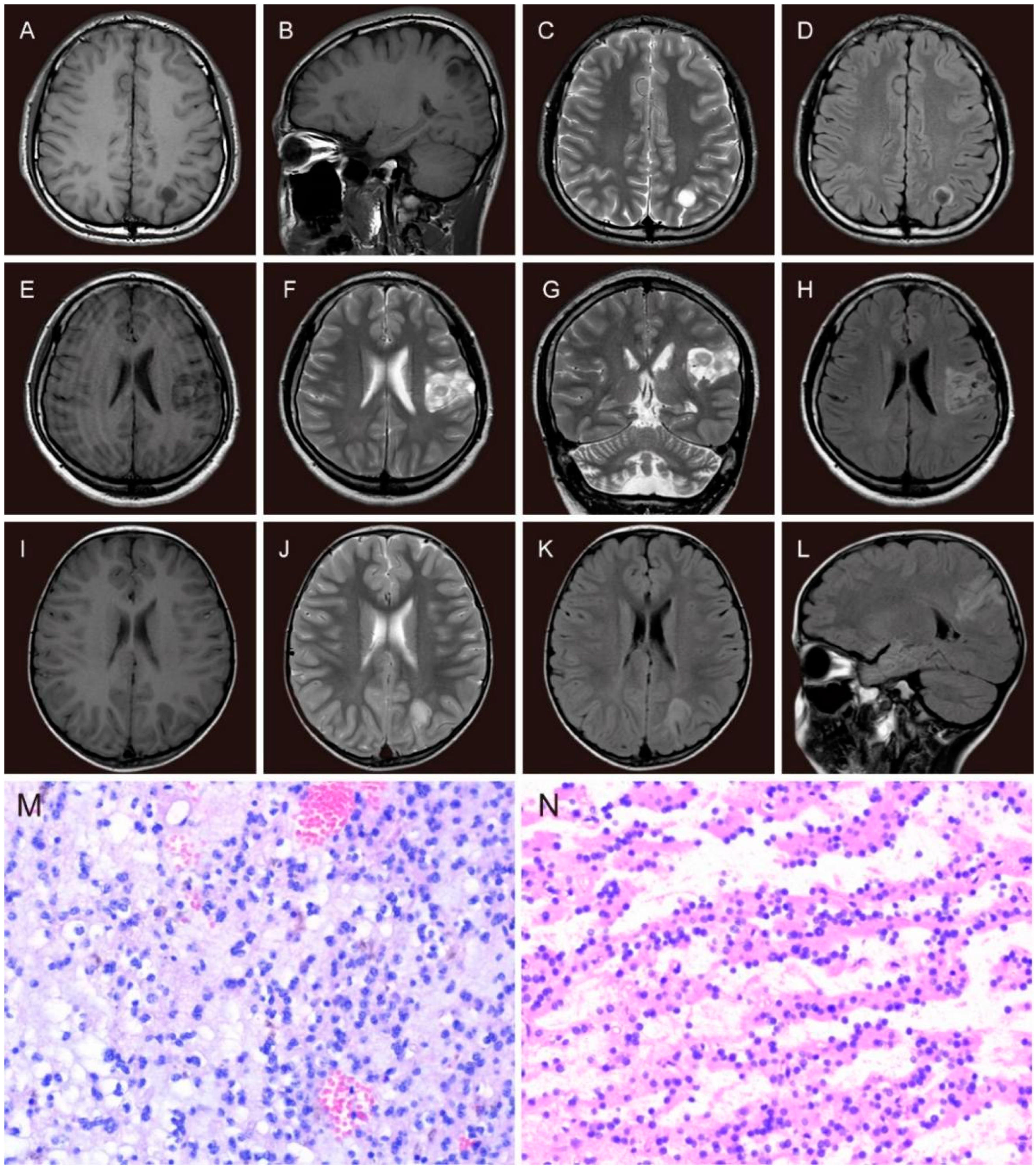 Brainsci 13 00024 g002 Brainsci 13 00024 g002