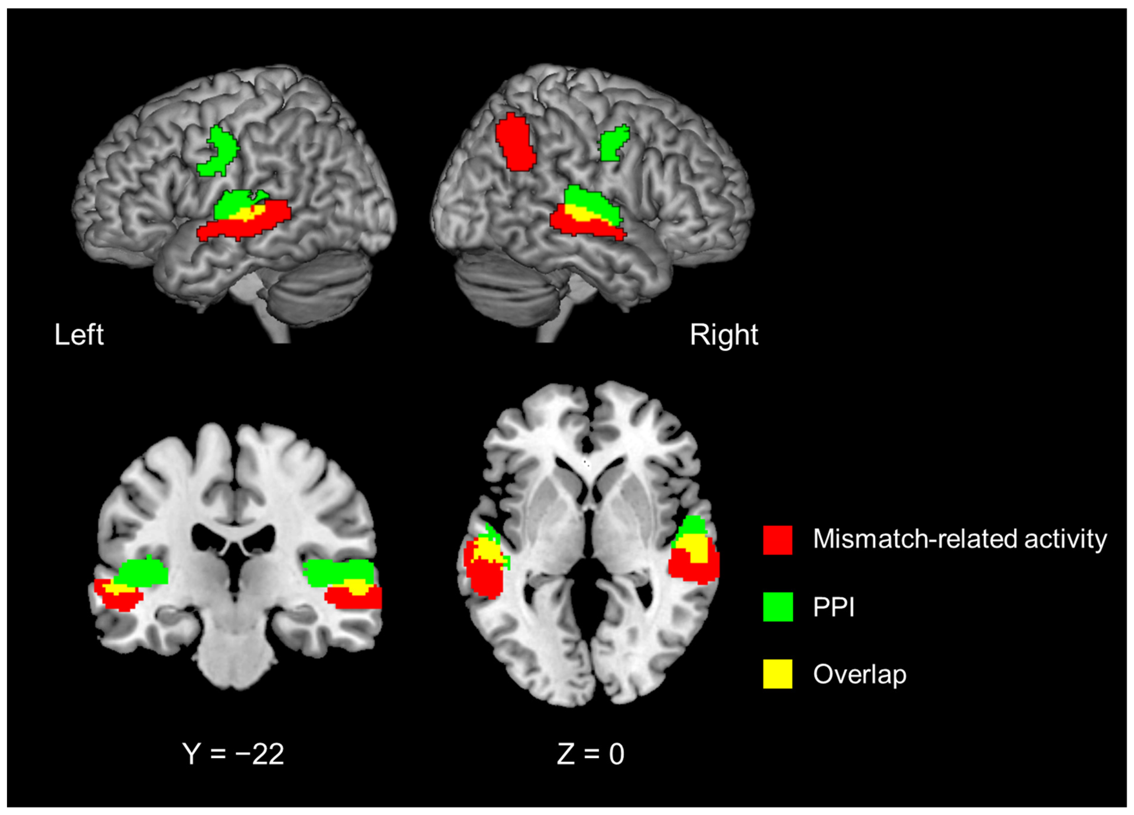 Brain Sciences | Free Full-Text | The Role Of The Left Inferior Frontal ...