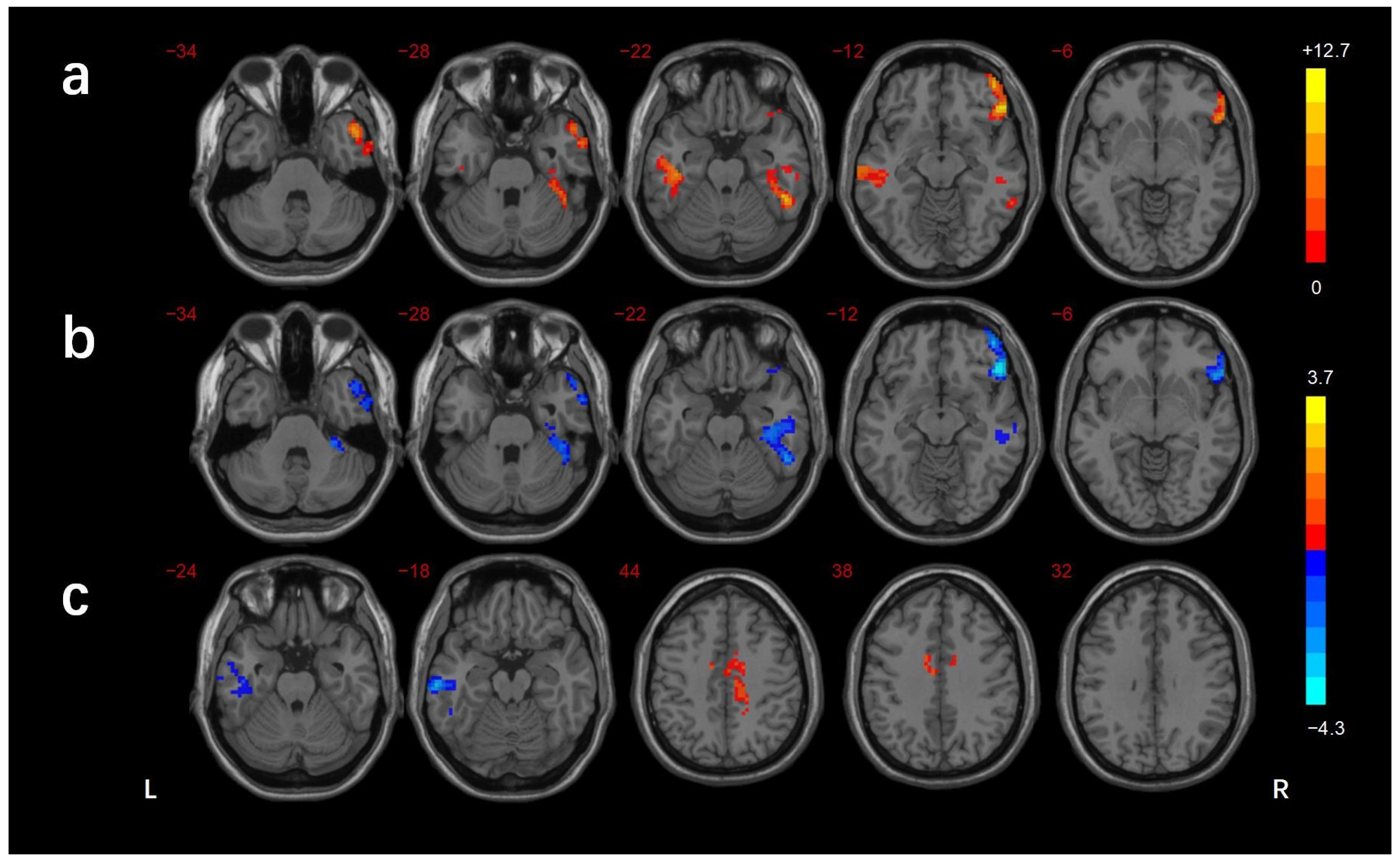 Brainsci 13 00144 g004