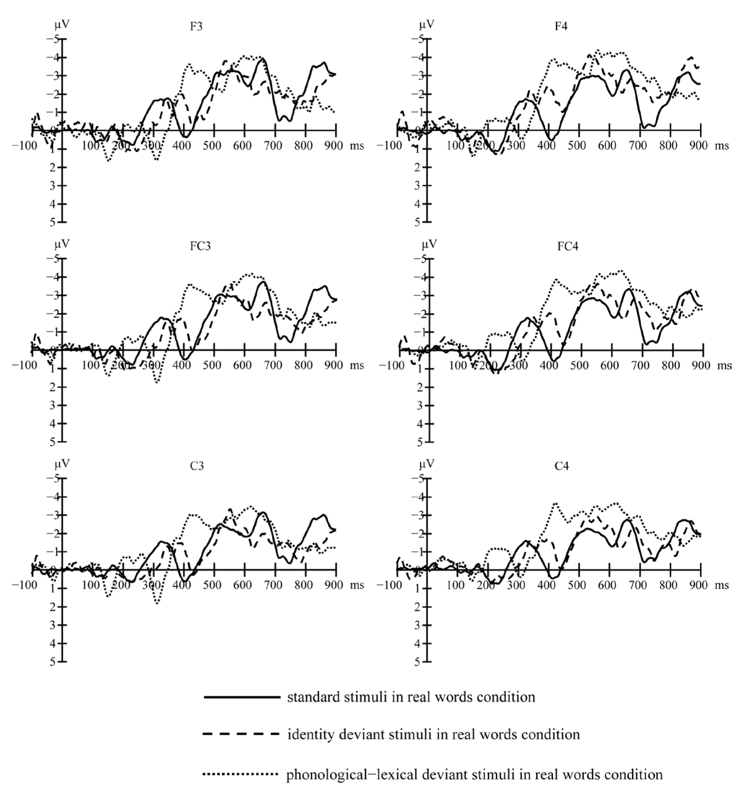 Jamii Linguists - Pronunciation is a critical part of listening