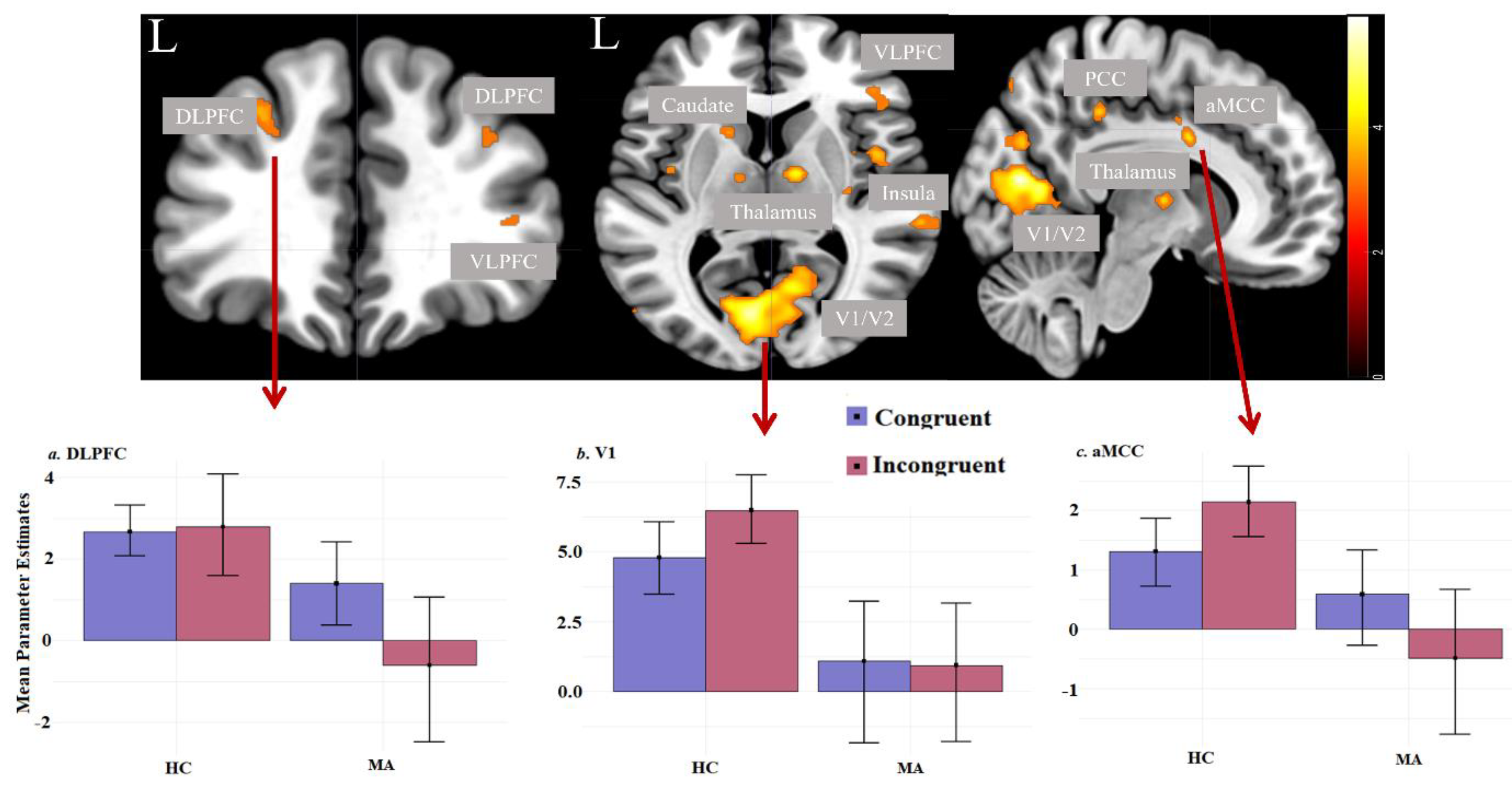 Whole-brain two-sample t-test results for the incongruent condition