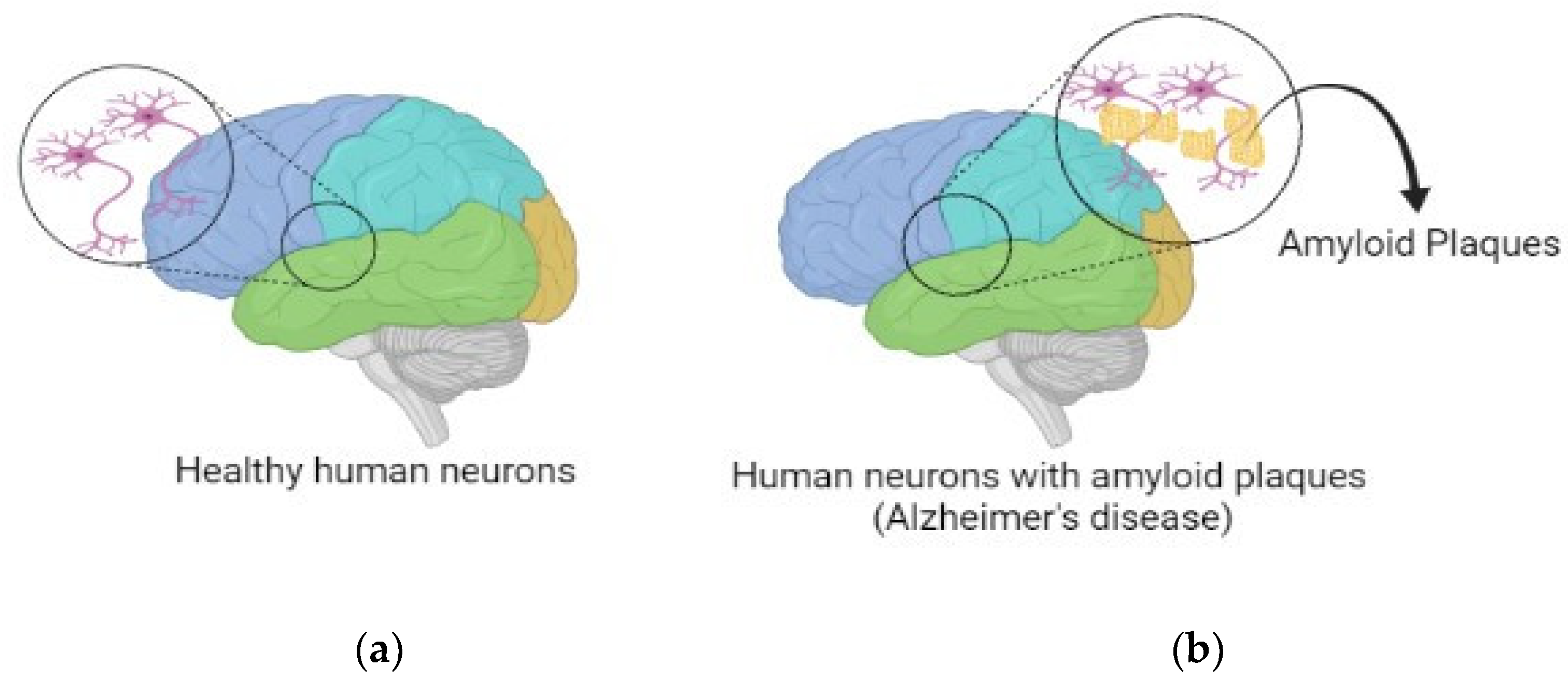 Brainsci 13 00213 g001