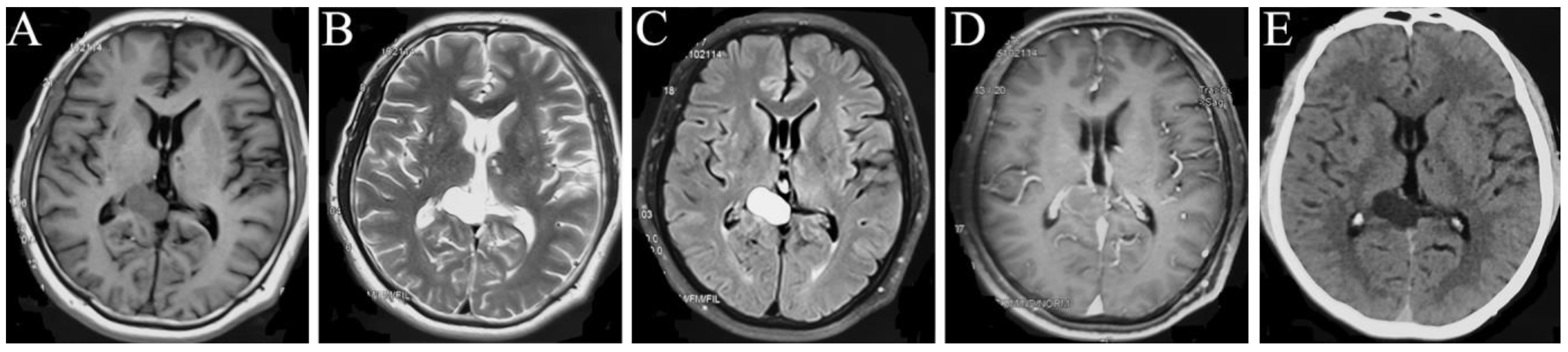 Brainsci 13 00239 g001 Brainsci 13 00239 g001