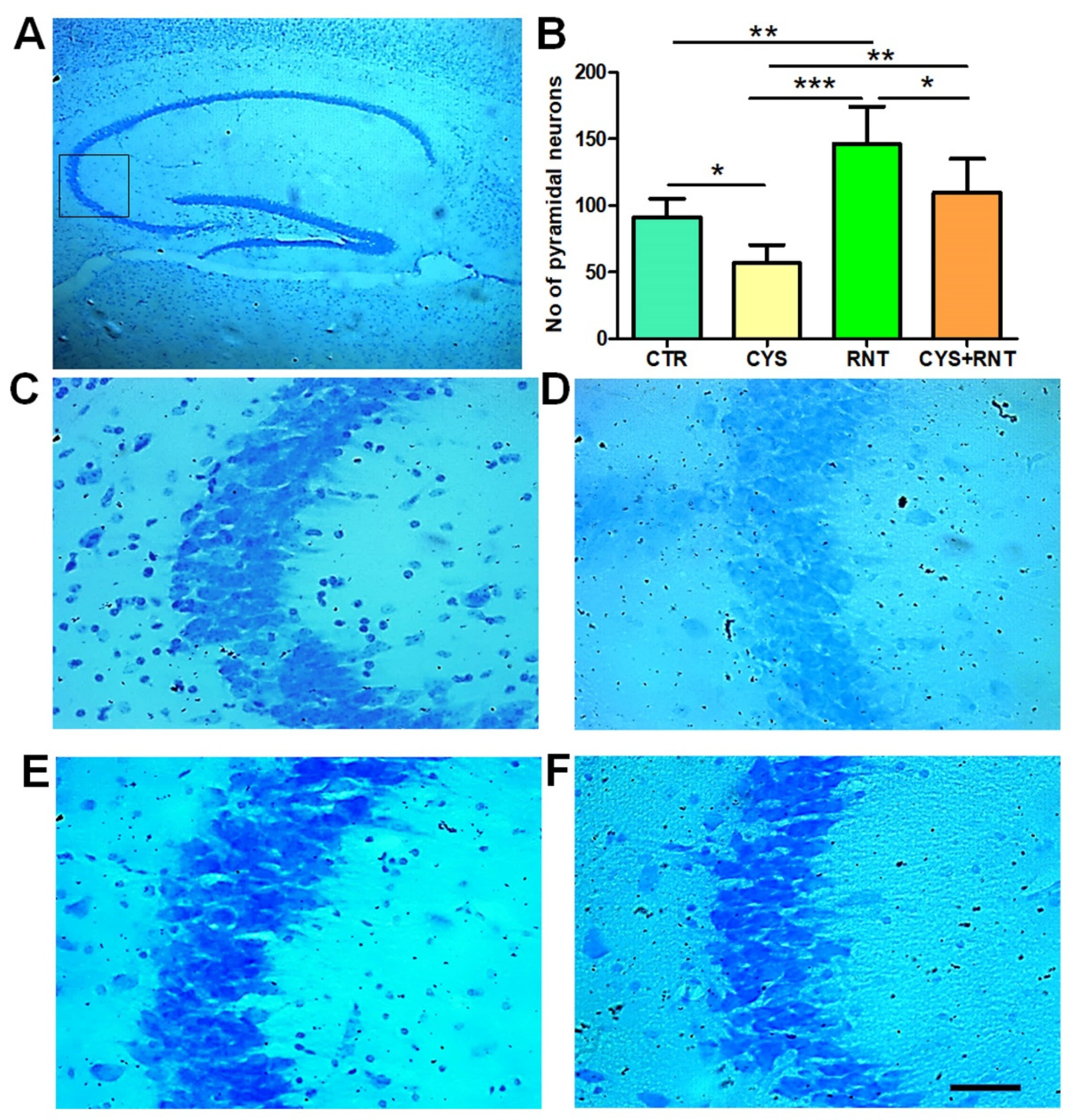 Brainsci 13 00266 g006 Brainsci 13 00266 g006