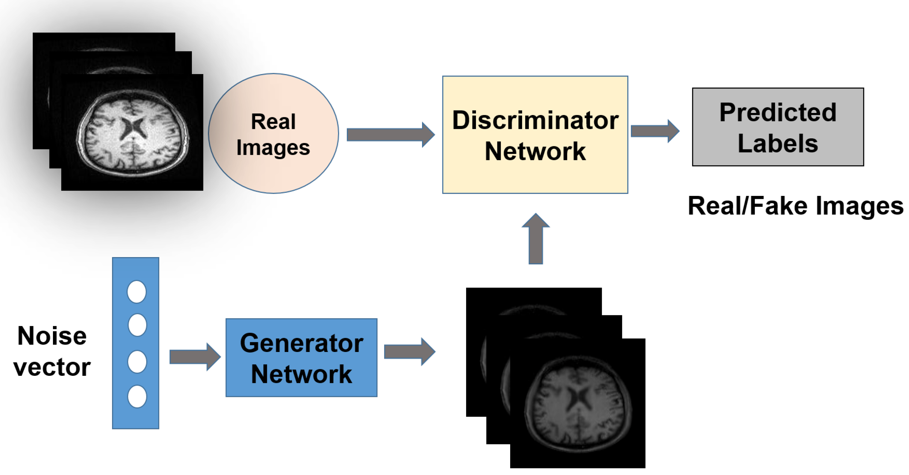 Fake brain 3 Diagram