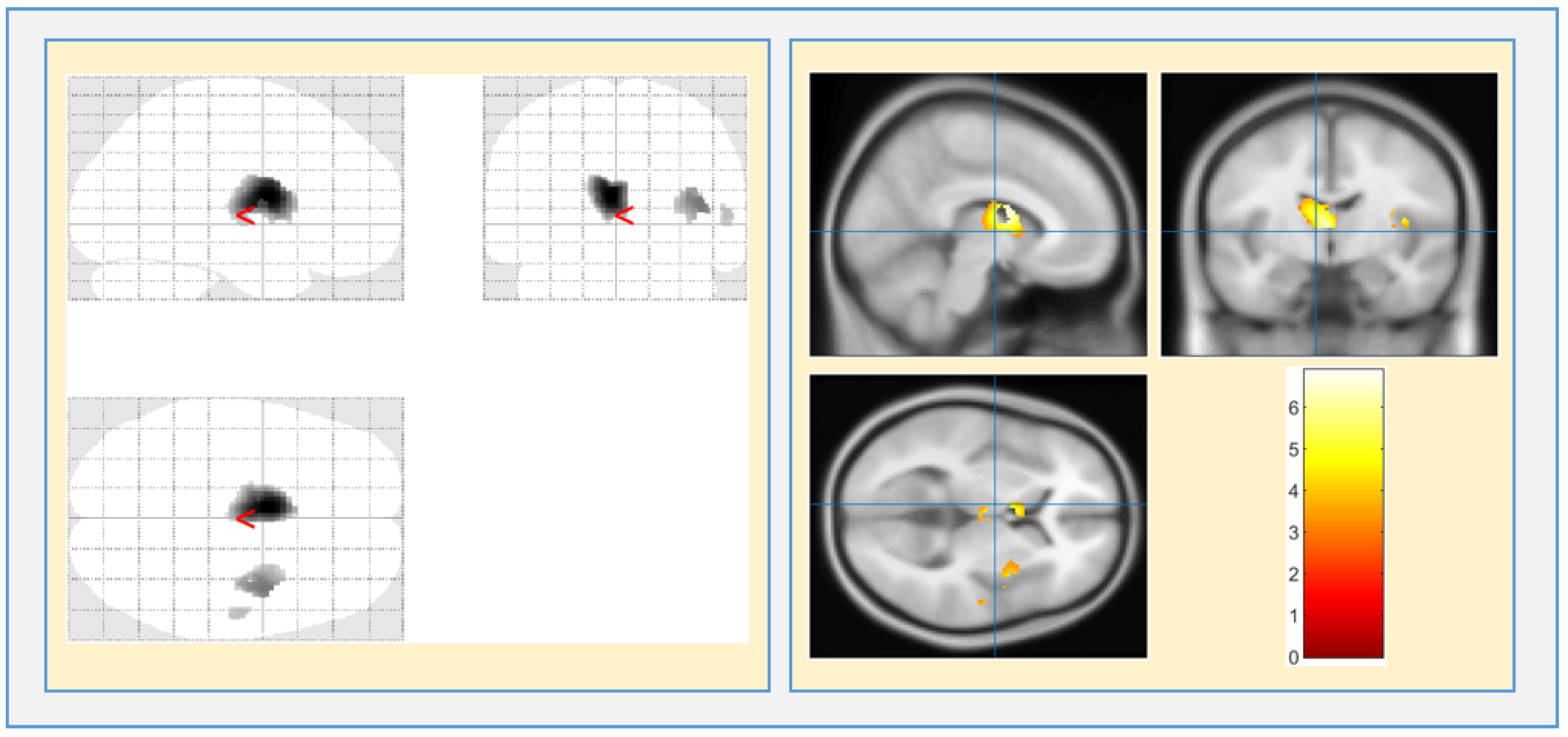 Brainsci 13 00267 g009 Brainsci 13 00267 g009