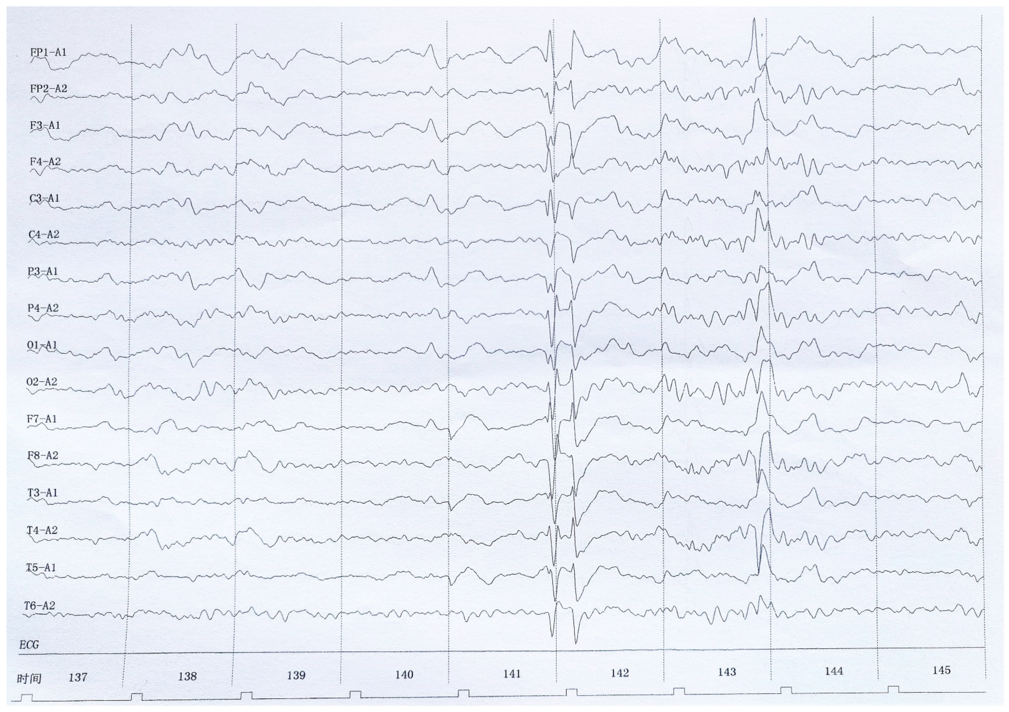 Brainsci 13 00283 g001