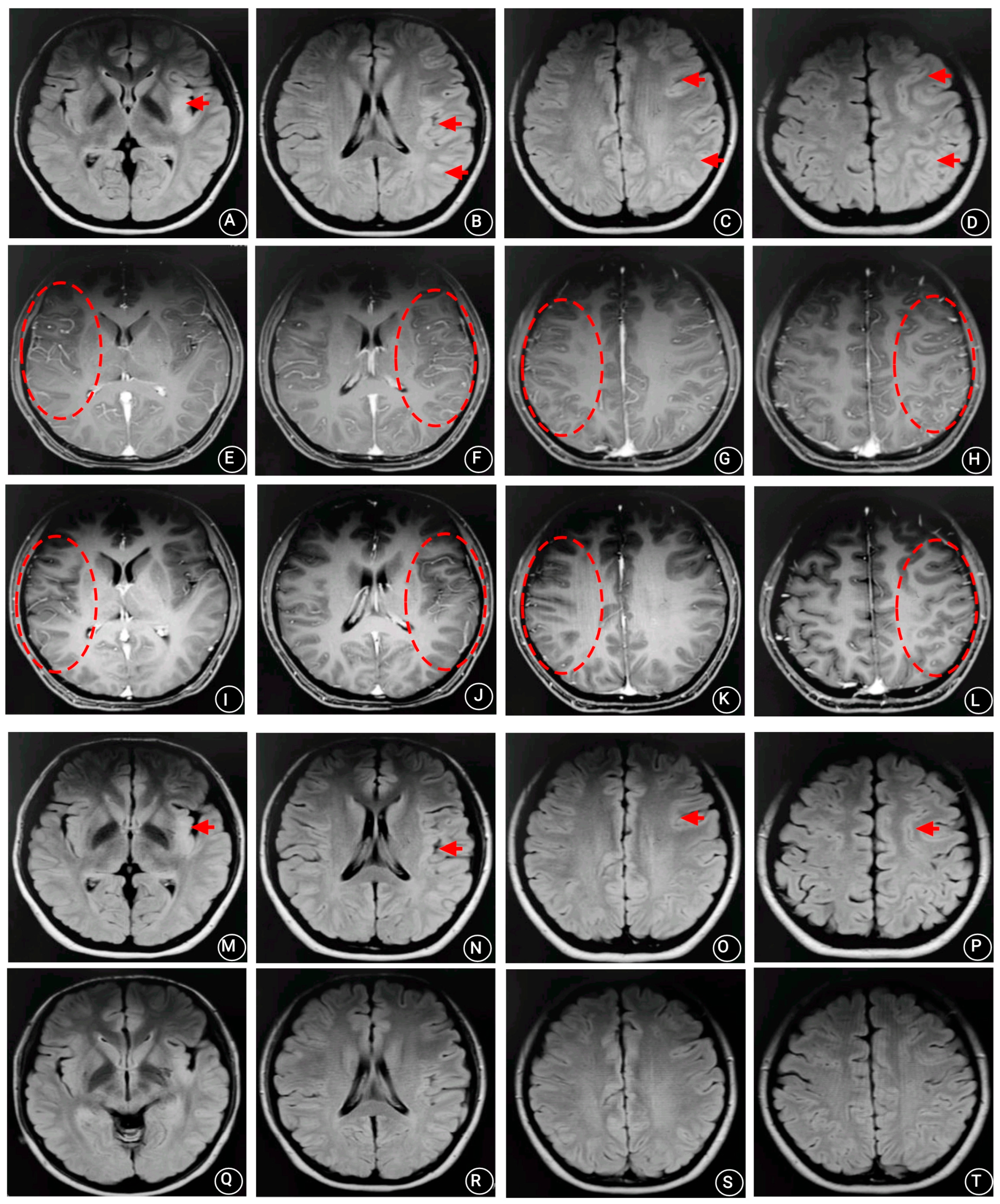 Brainsci 13 00283 g002