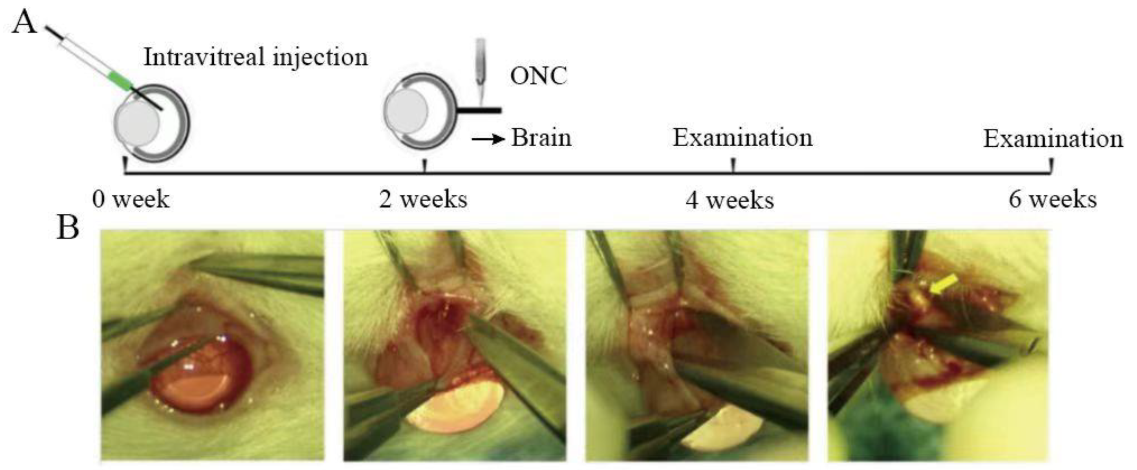Brainsci 13 00404 g002 Brainsci 13 00404 g002
