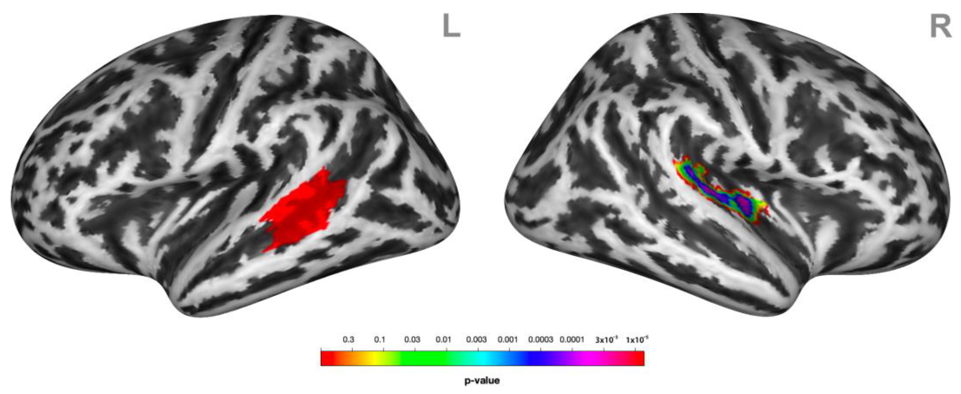 Brainsci 13 00474 g004 Brainsci 13 00474 g004