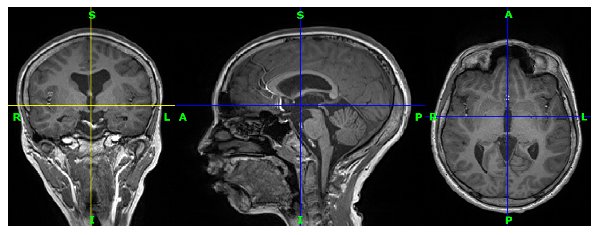 Brainsci 13 00487 g005 Brainsci 13 00487 g005