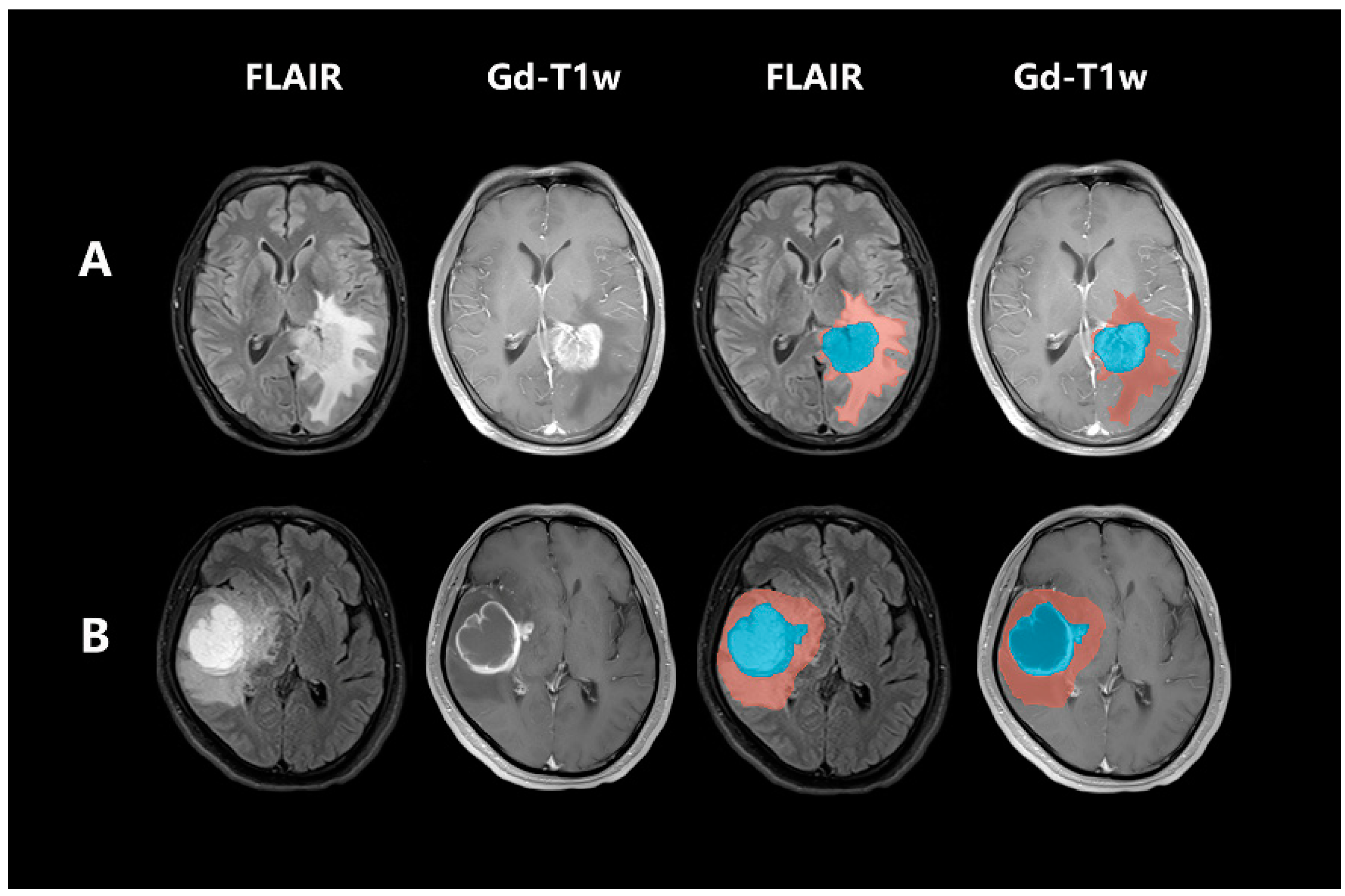 Brainsci 13 00548 g002