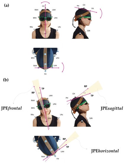 Brain Sciences Free Full Text Cervical Proprioception Assessed Through Targeted Head 3926