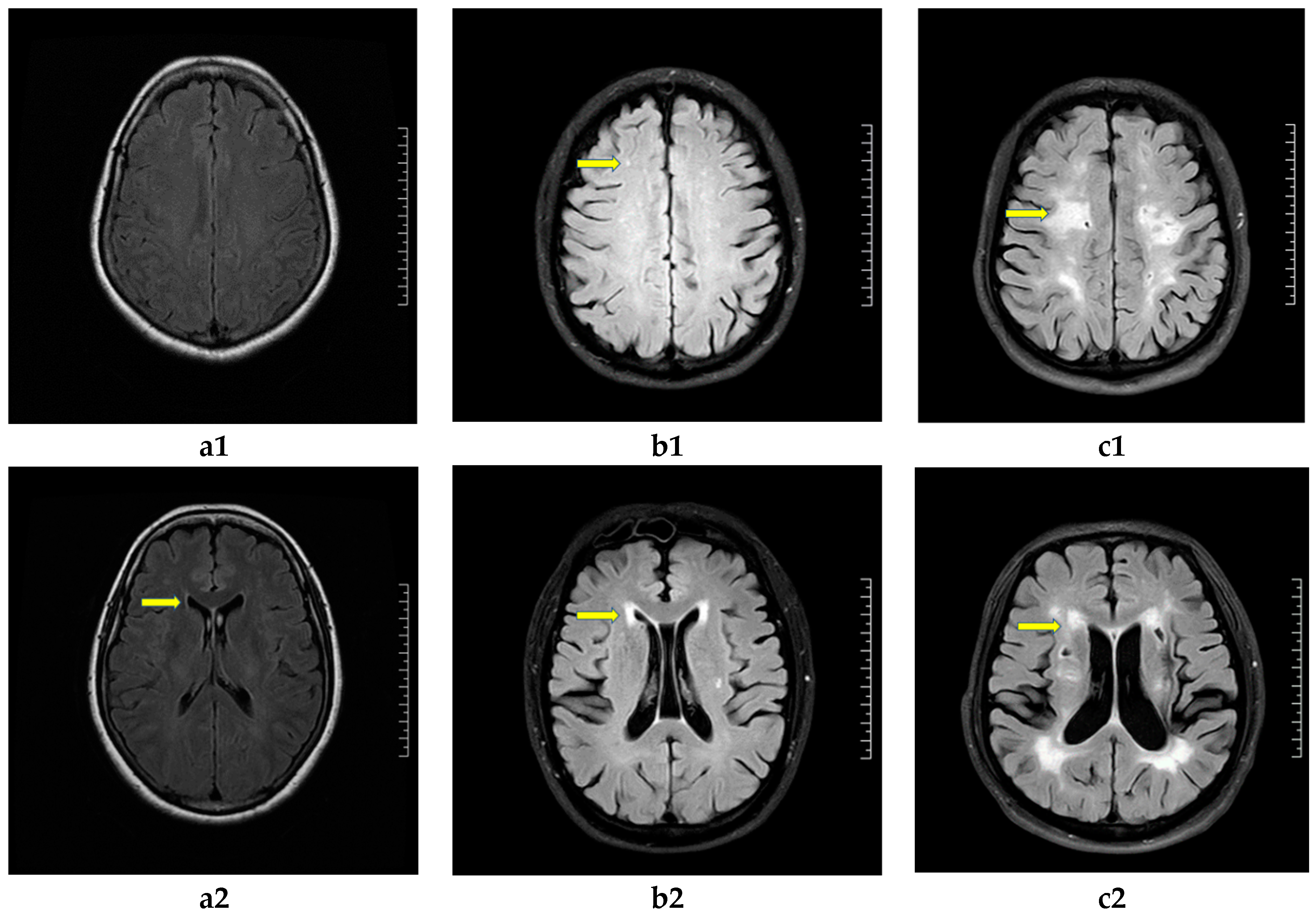 Brainsci 13 00616 g001 Brainsci 13 00616 g001