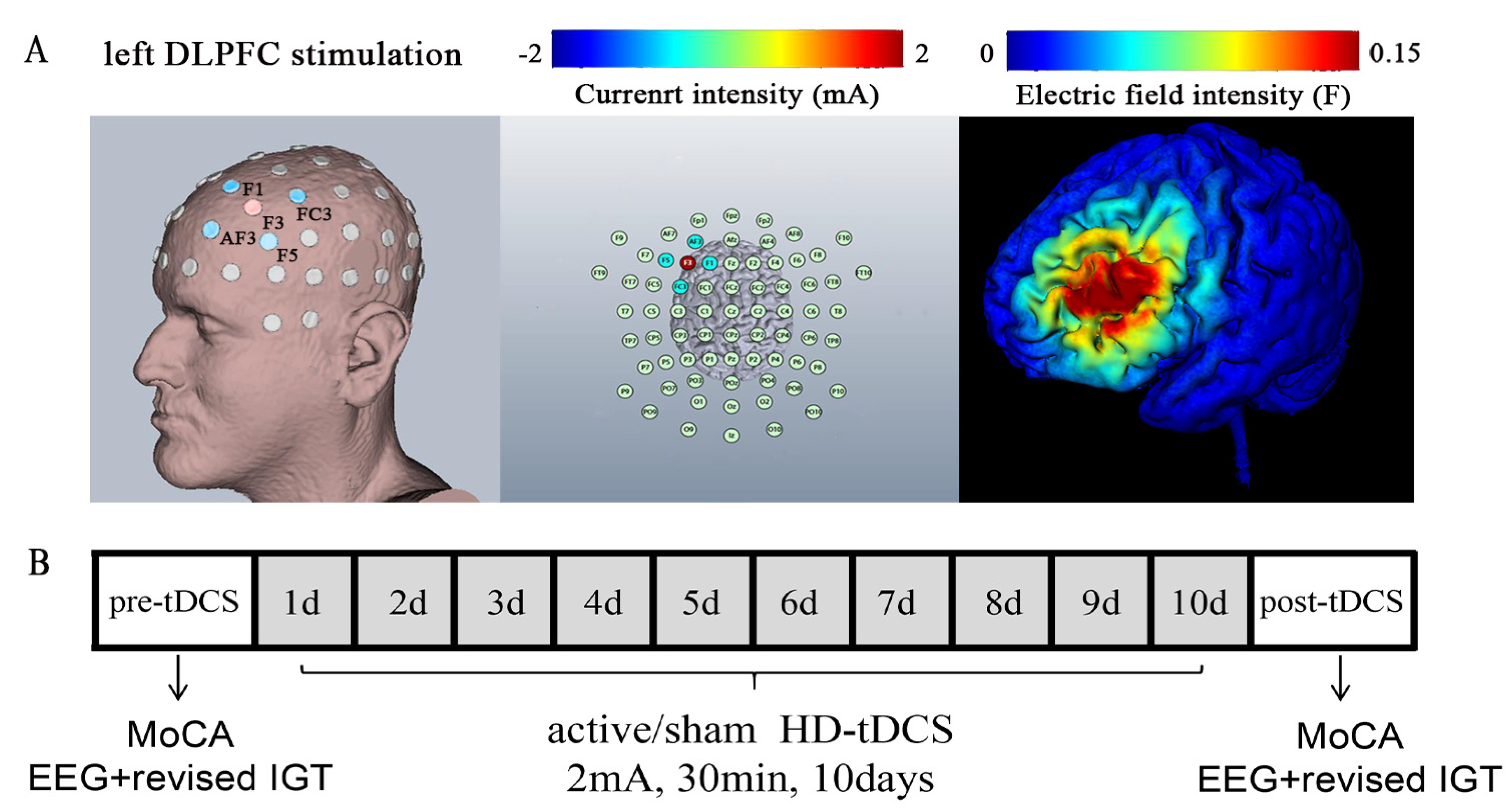 Frontiers  Randomized Controlled Study Evaluating Efficiency of Low  Intensity Transcranial Direct Current Stimulation (tDCS) for Dyspnea Relief  in Mechanically Ventilated COVID-19 Patients in ICU: The tDCS-DYSP-COVID  Protocol