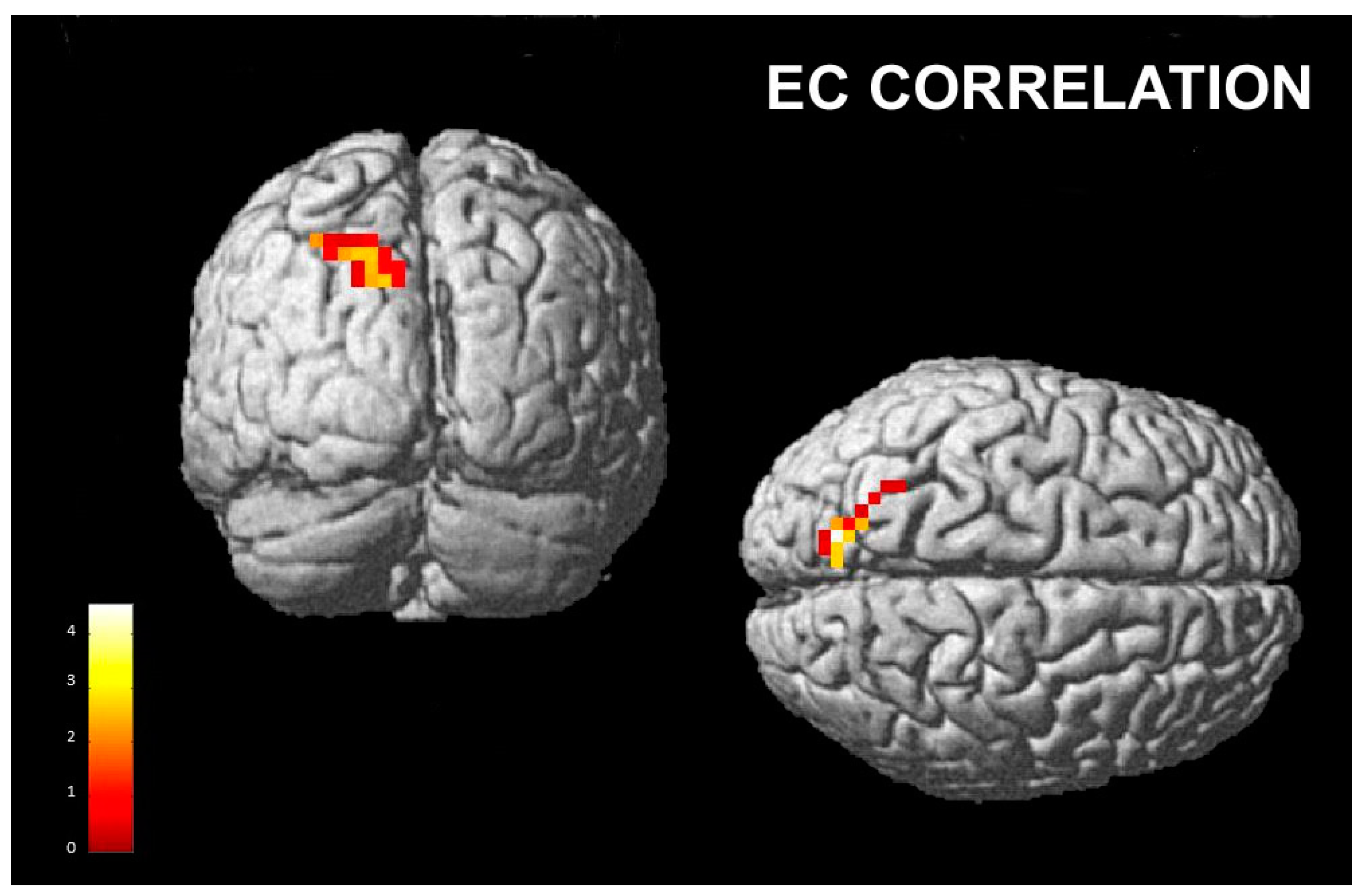 Brainsci 13 00668 g004 Brainsci 13 00668 g004