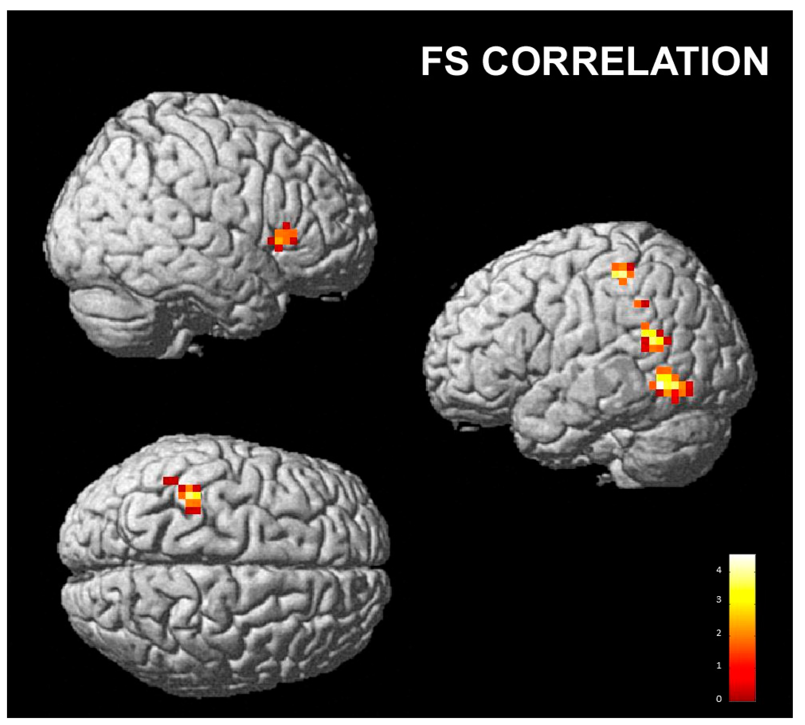 Brainsci 13 00668 g005 Brainsci 13 00668 g005