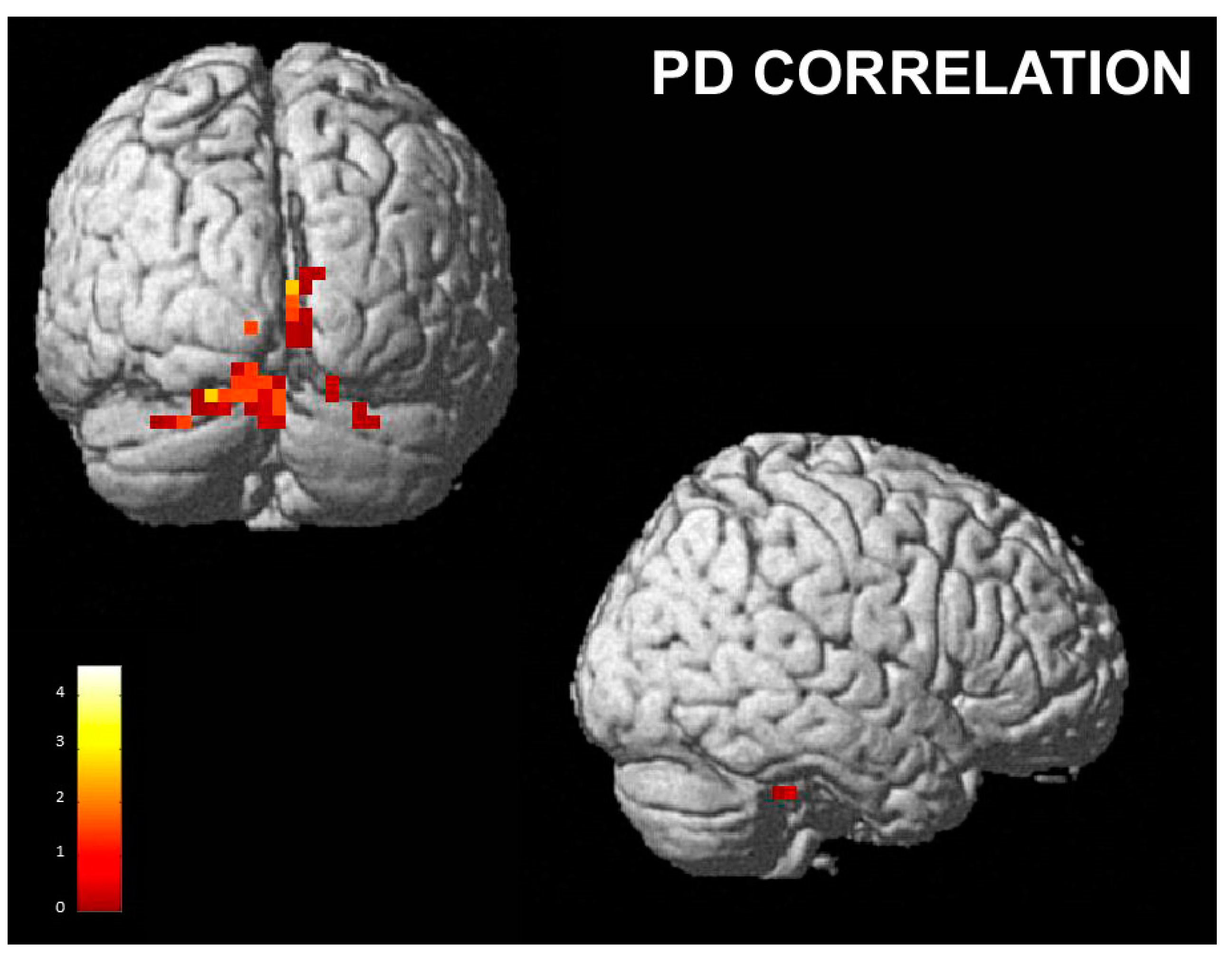 Brainsci 13 00668 g006 Brainsci 13 00668 g006