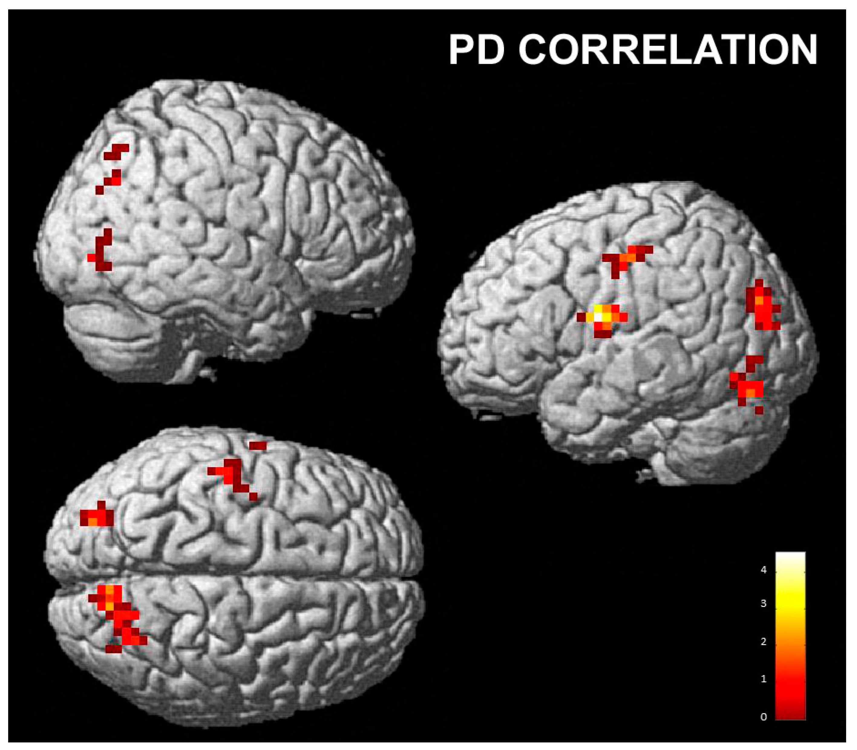 Brainsci 13 00668 g007 Brainsci 13 00668 g007