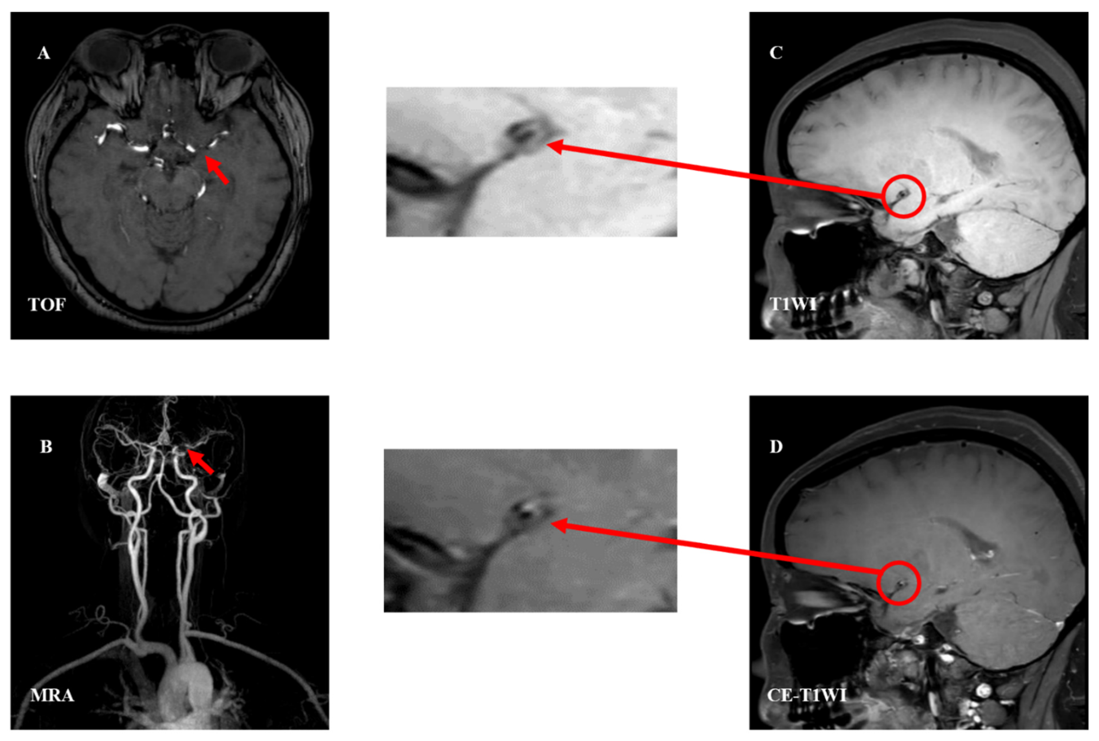 Brainsci 13 00677 g002