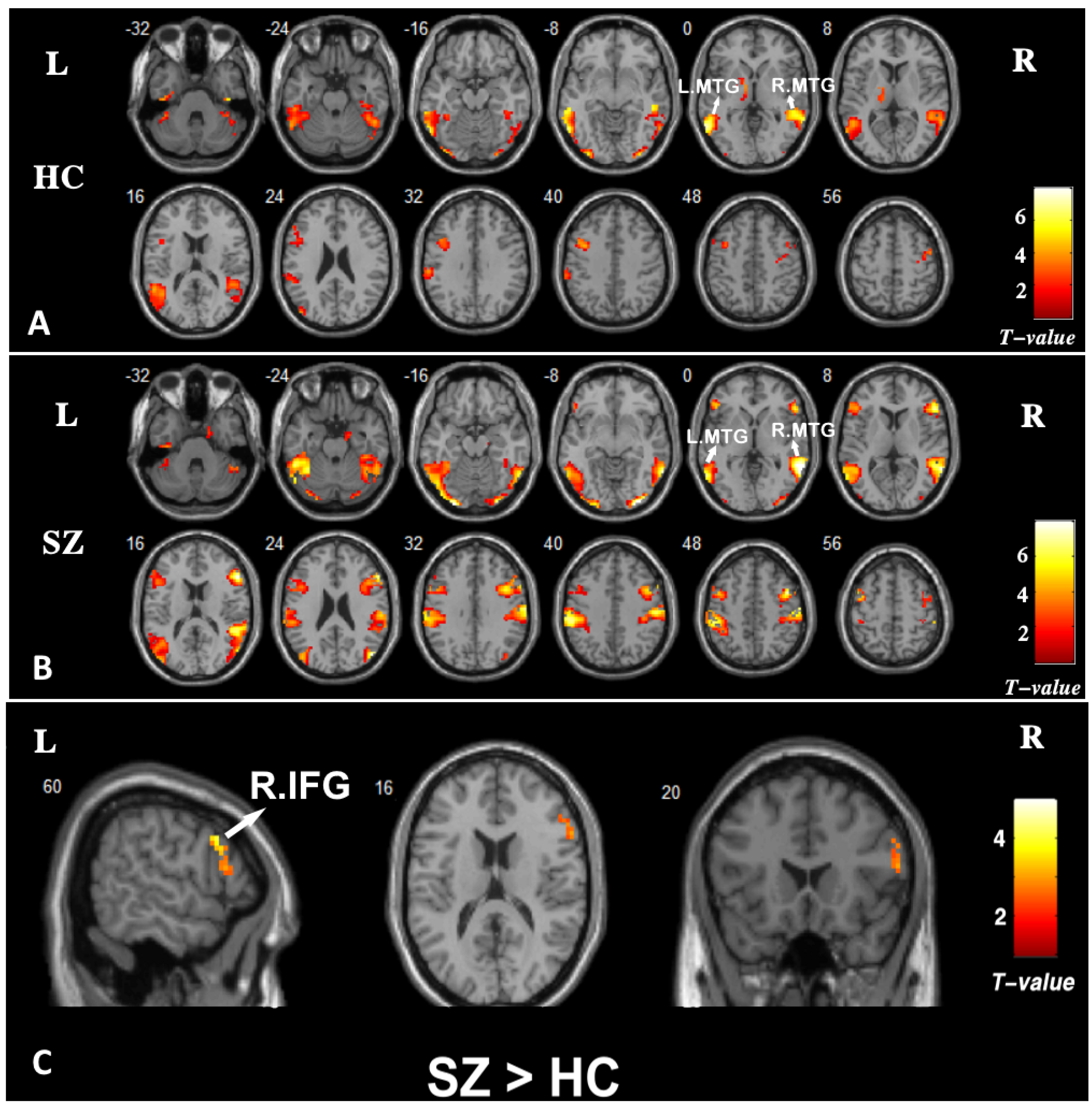 Brainsci 13 00692 g003