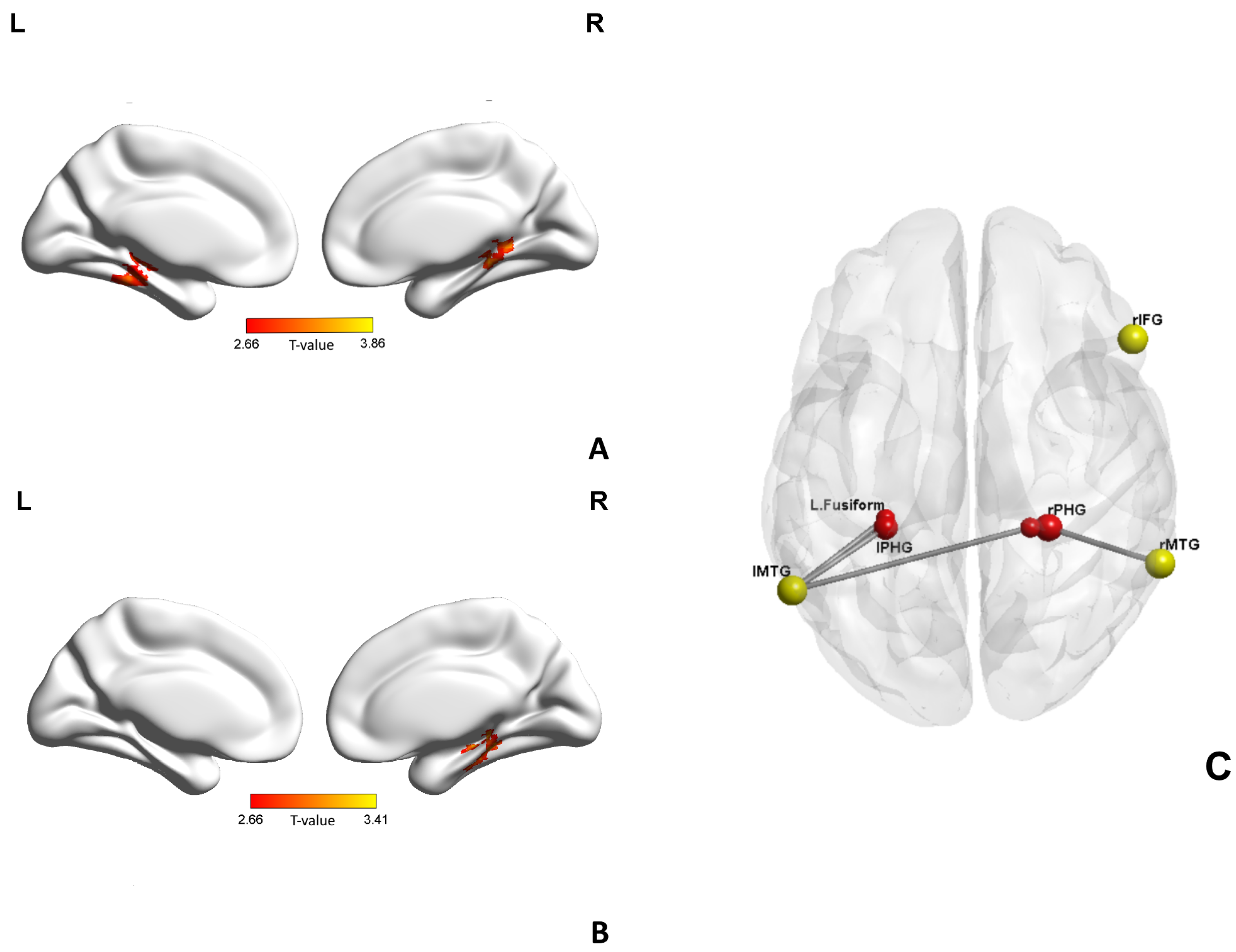 Brainsci 13 00692 g004