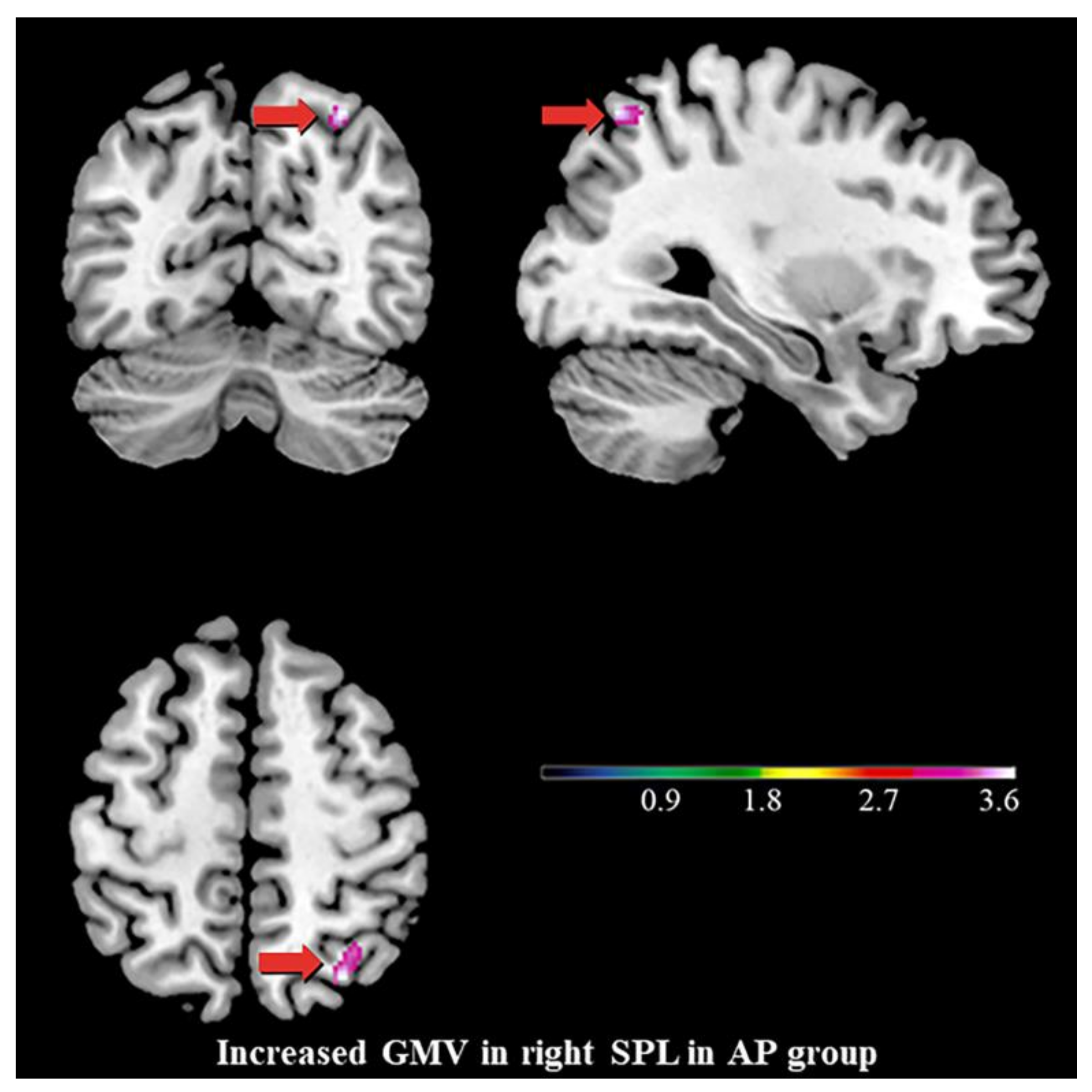 Brainsci 13 00694 g002