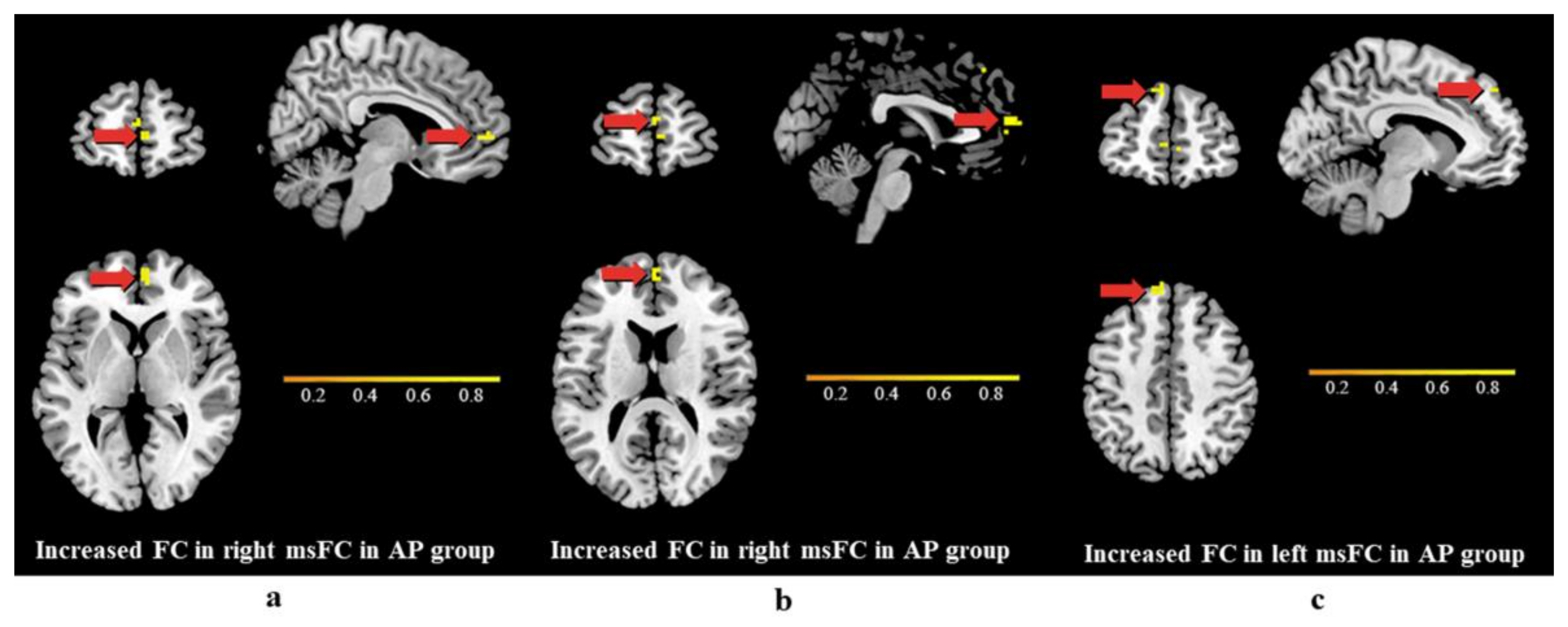 Brainsci 13 00694 g003