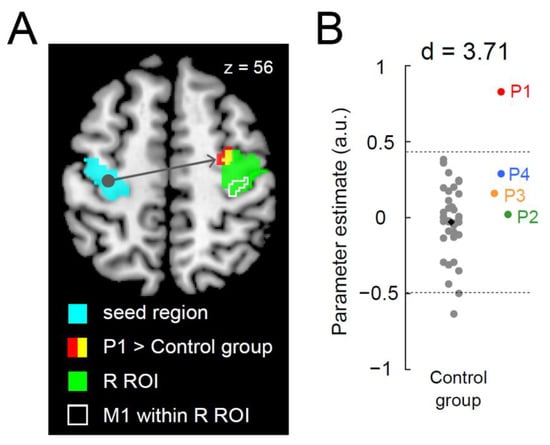 Brain Sciences | Free Full-Text | Functional and Structural