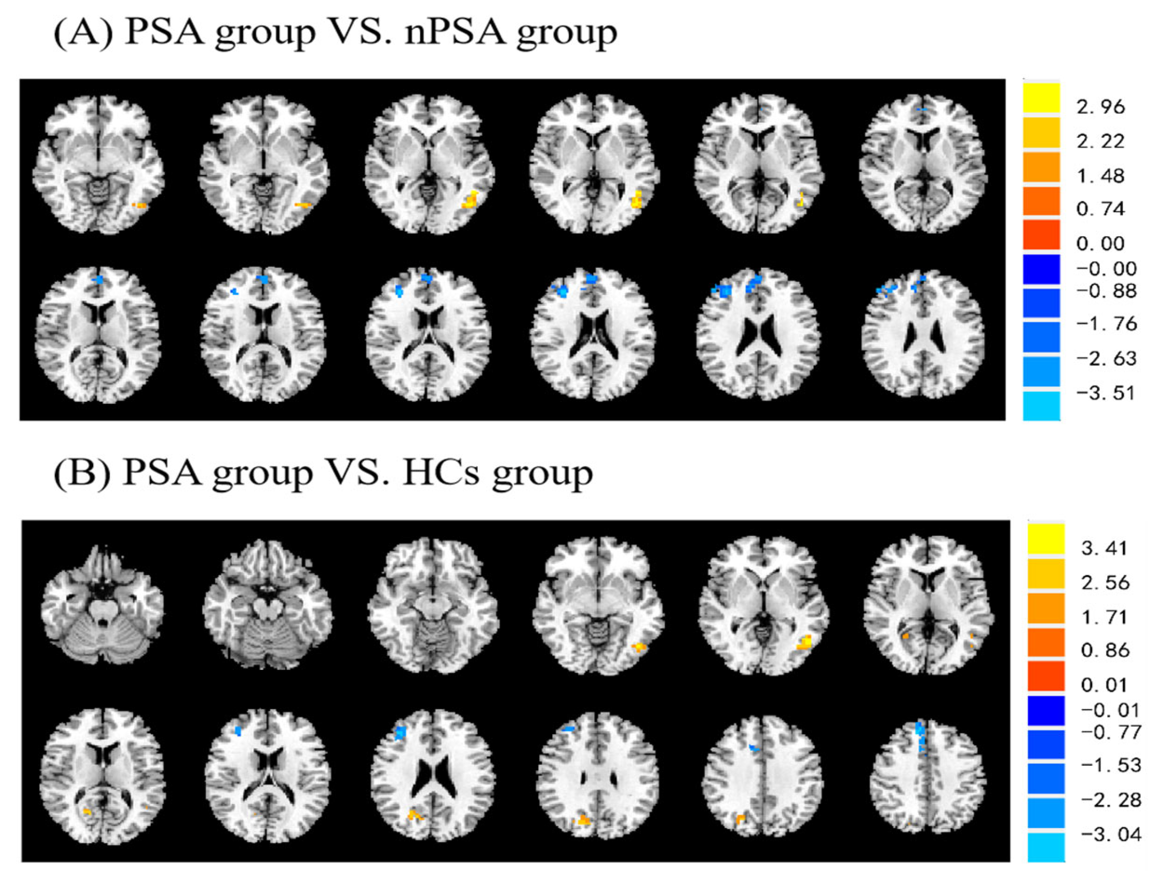 Brainsci 13 00730 g001