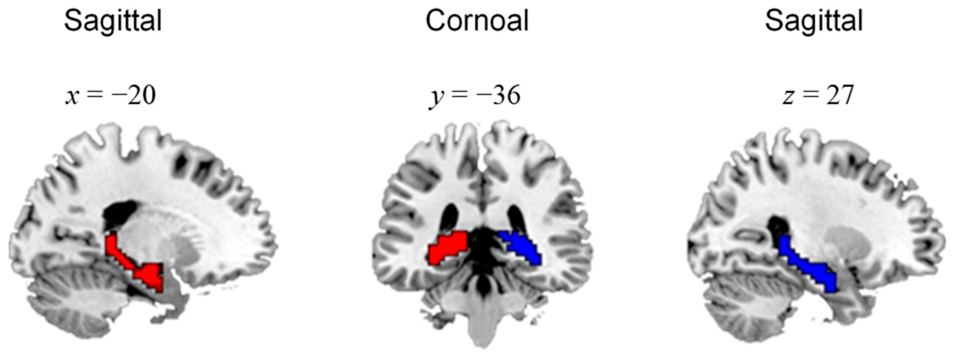 brain hippocampus coronal