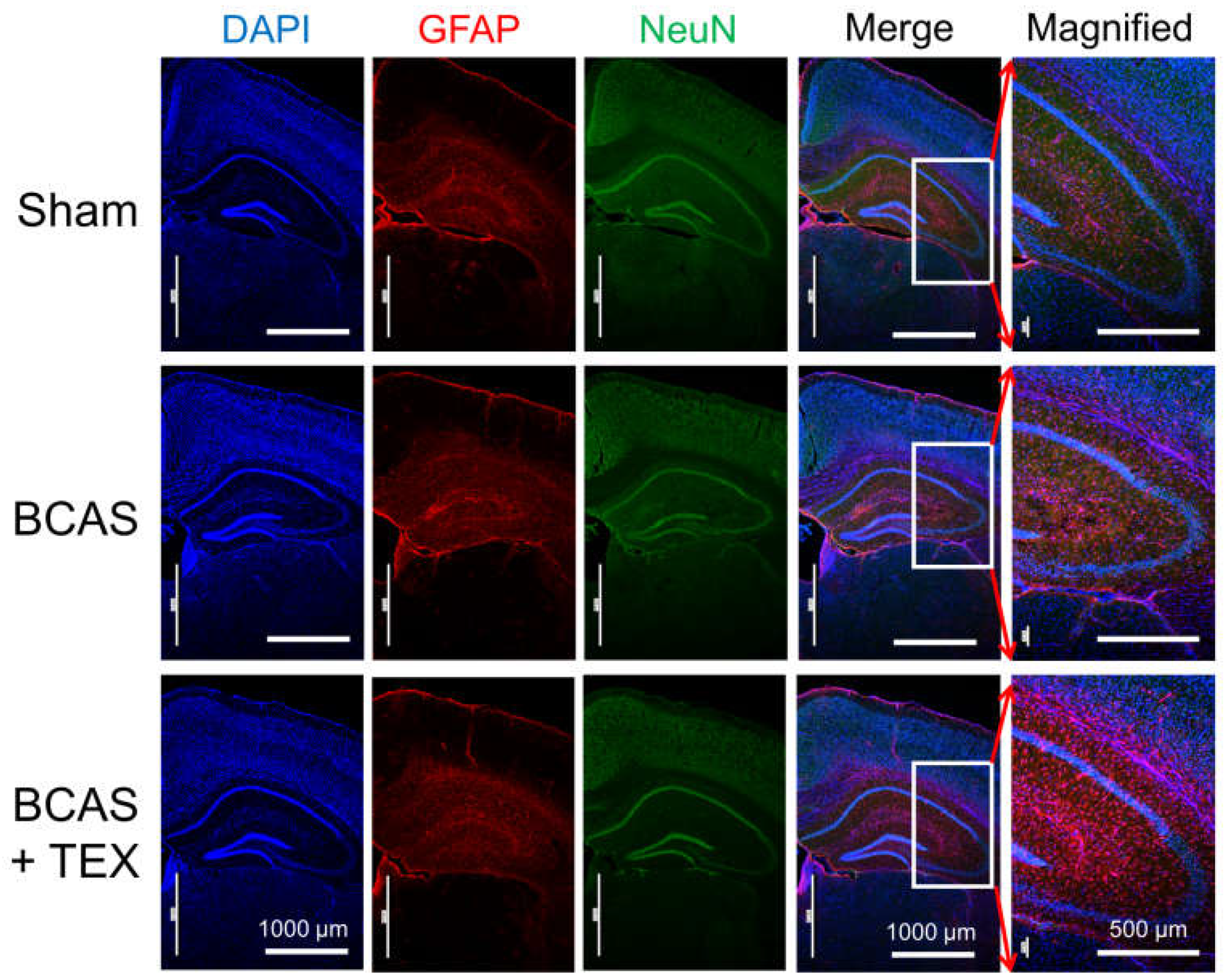 Brainsci 13 00781 g005