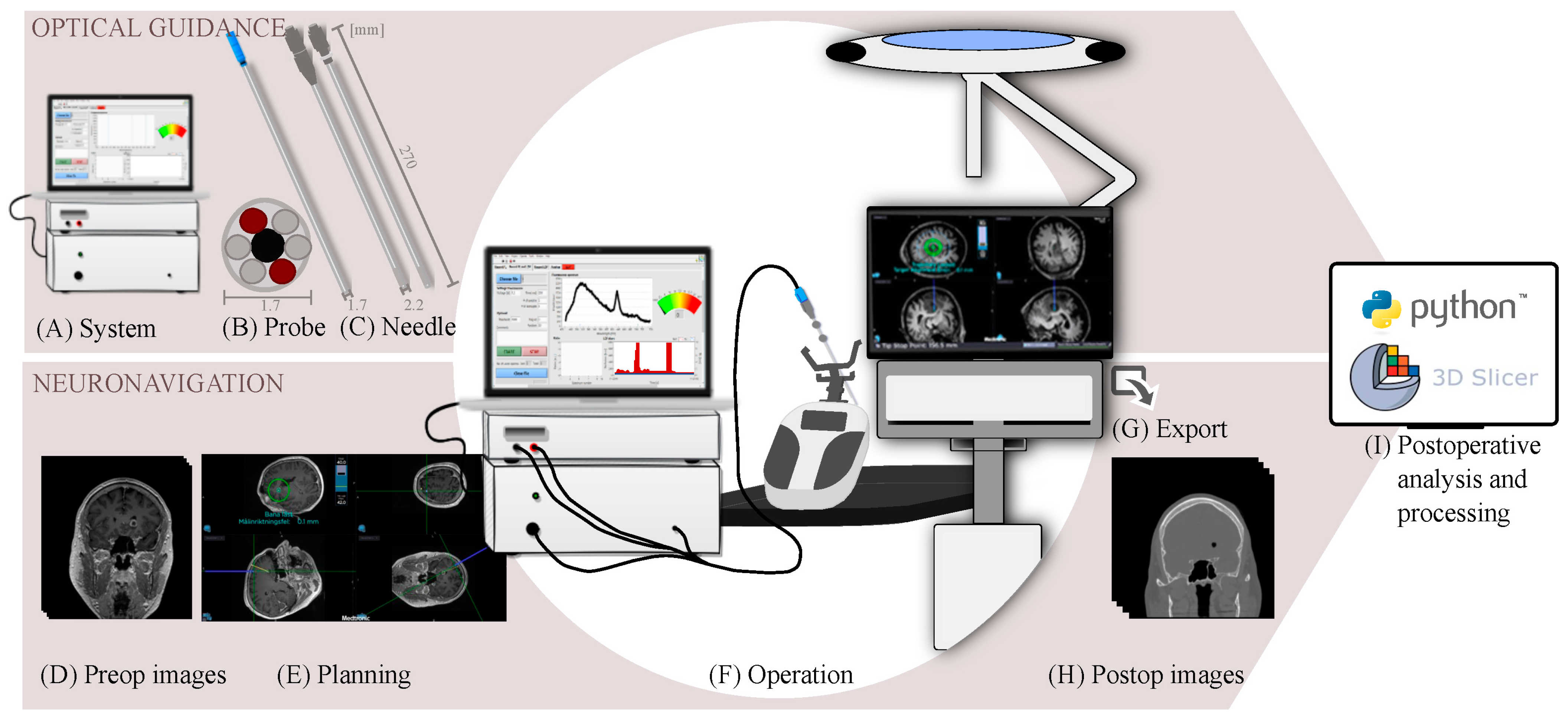 Brain Sciences | Free Full-Text | Combined Use of Frameless ...