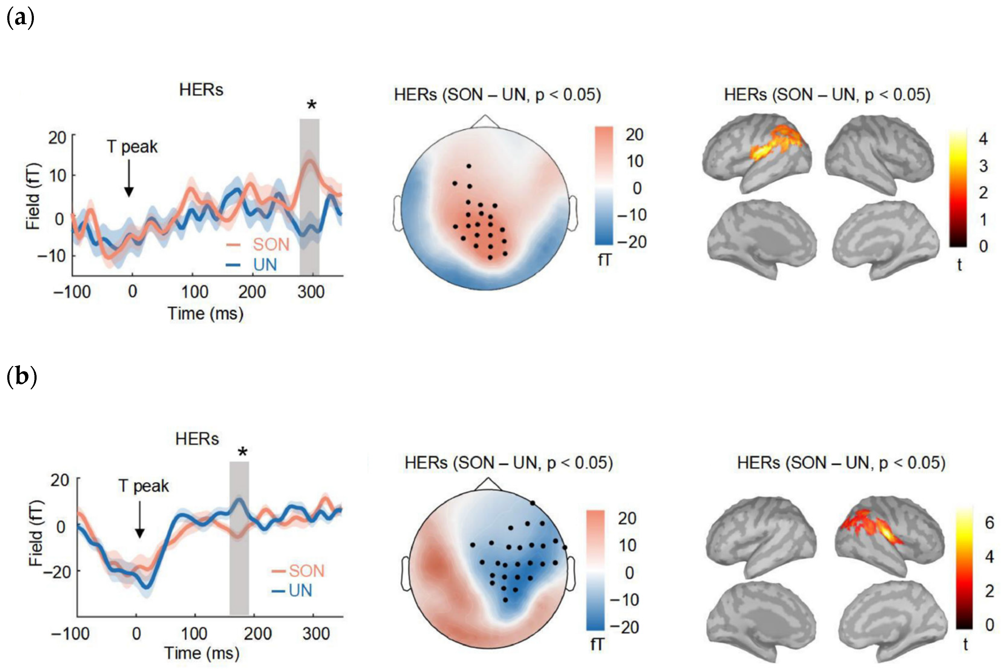 Brain Sciences | Free Full-Text | Brain State Relays Self