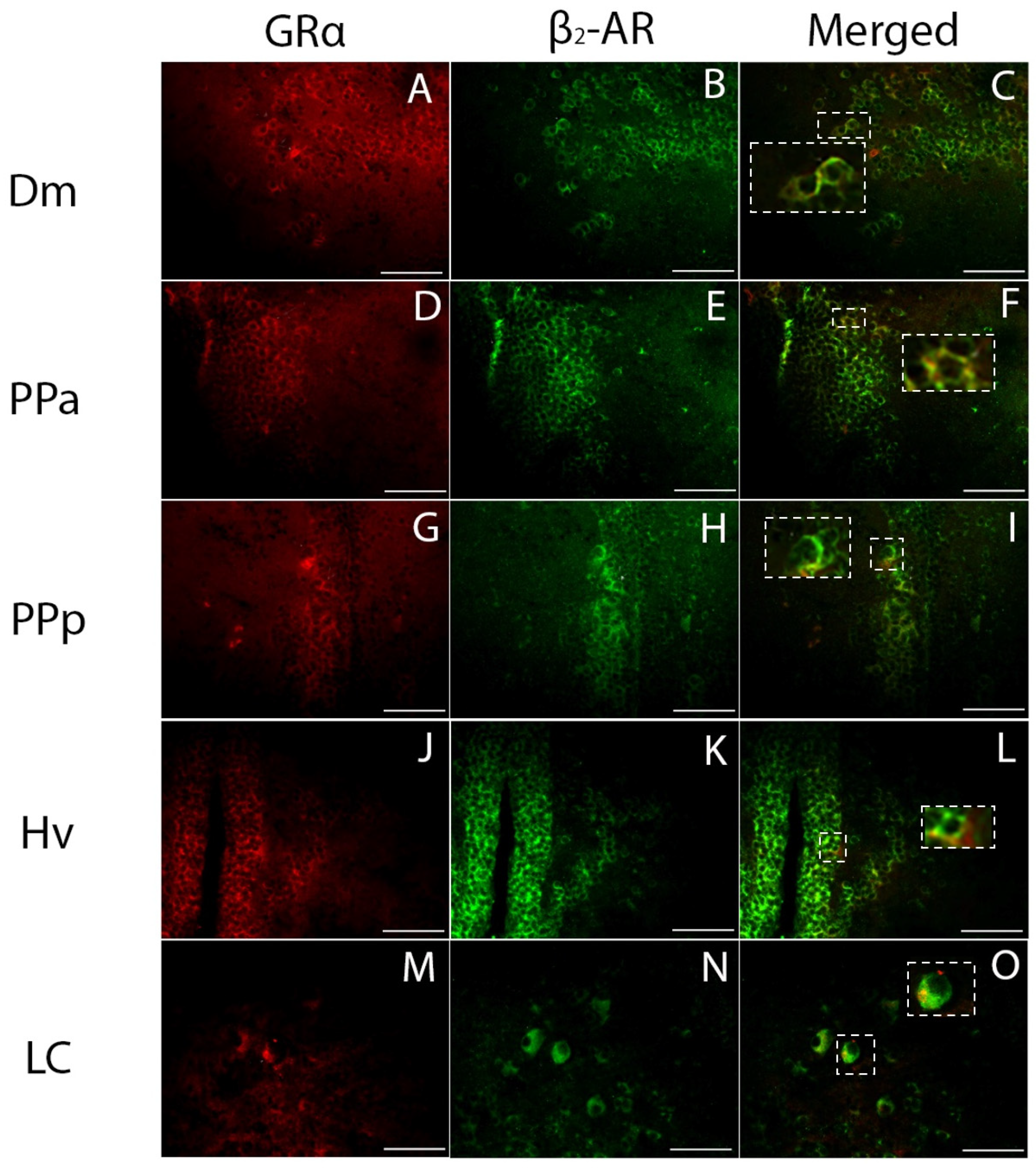 Brainsci 13 00861 g005 Brainsci 13 00861 g005