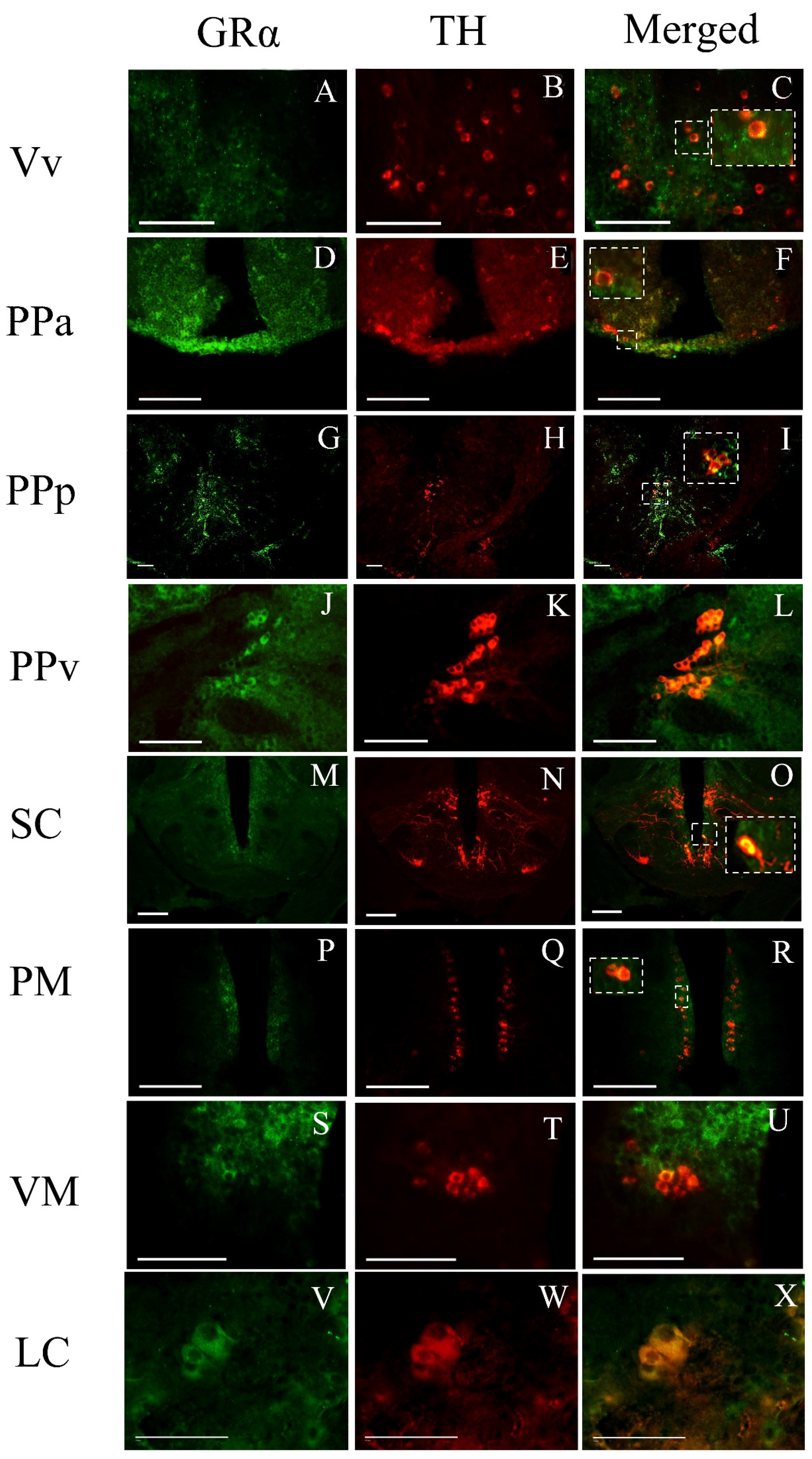 Brainsci 13 00861 g006 Brainsci 13 00861 g006