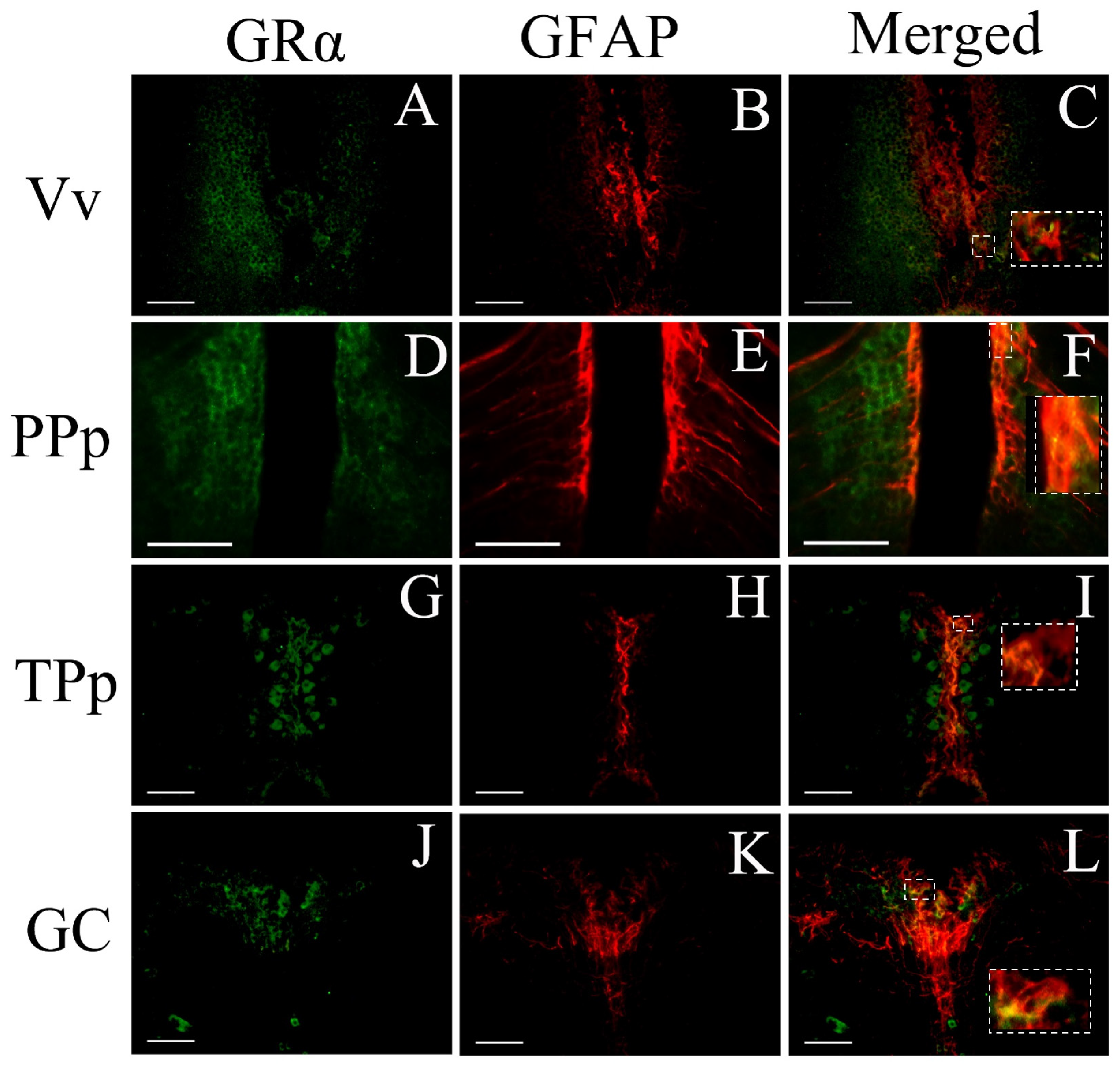 Brainsci 13 00861 g008 Brainsci 13 00861 g008