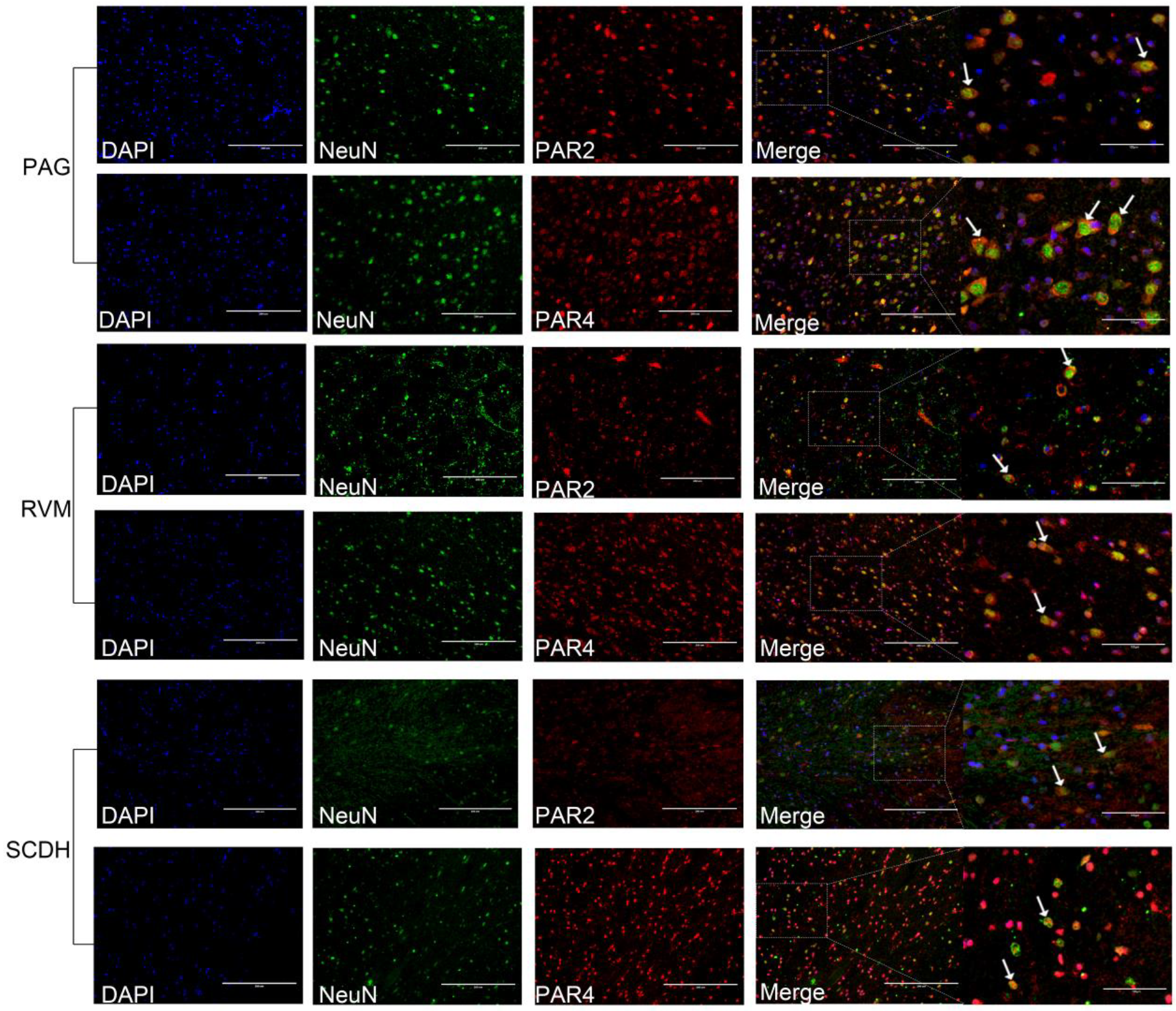 Brainsci 13 00922 g007 Brainsci 13 00922 g007