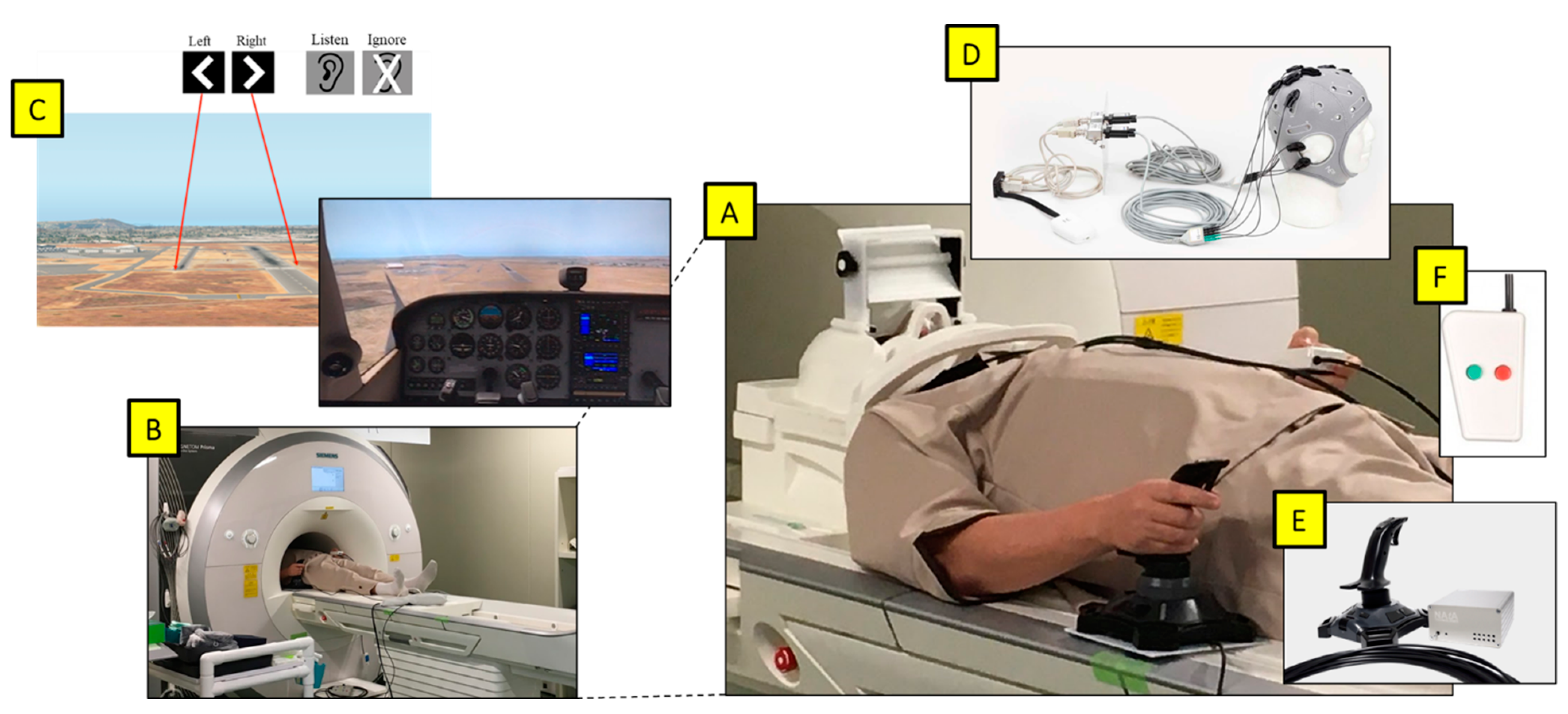 Brain Sciences | Free Full-Text | Simultaneous fMRI and tDCS for