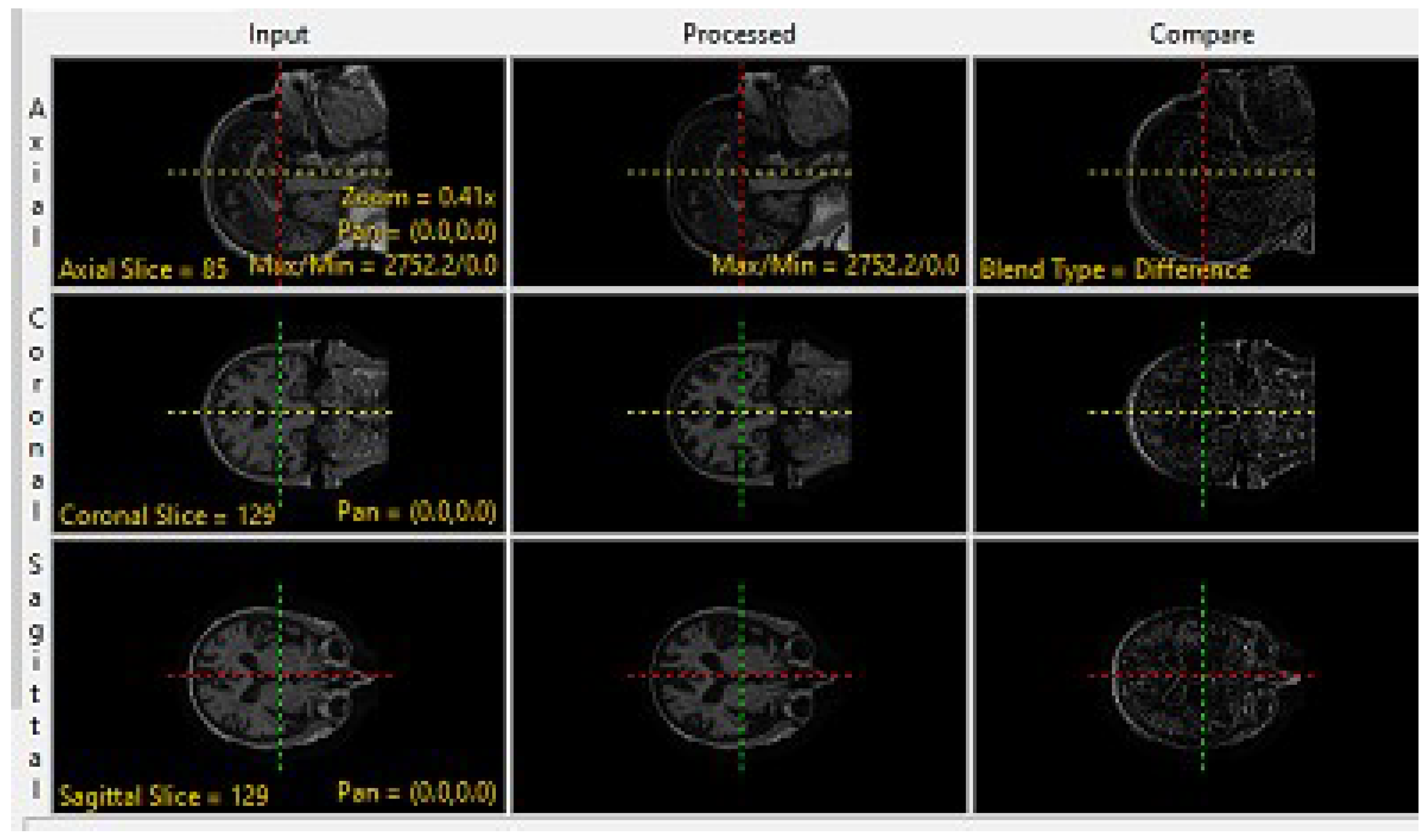 Brainsci 13 01045 g002 Brainsci 13 01045 g002