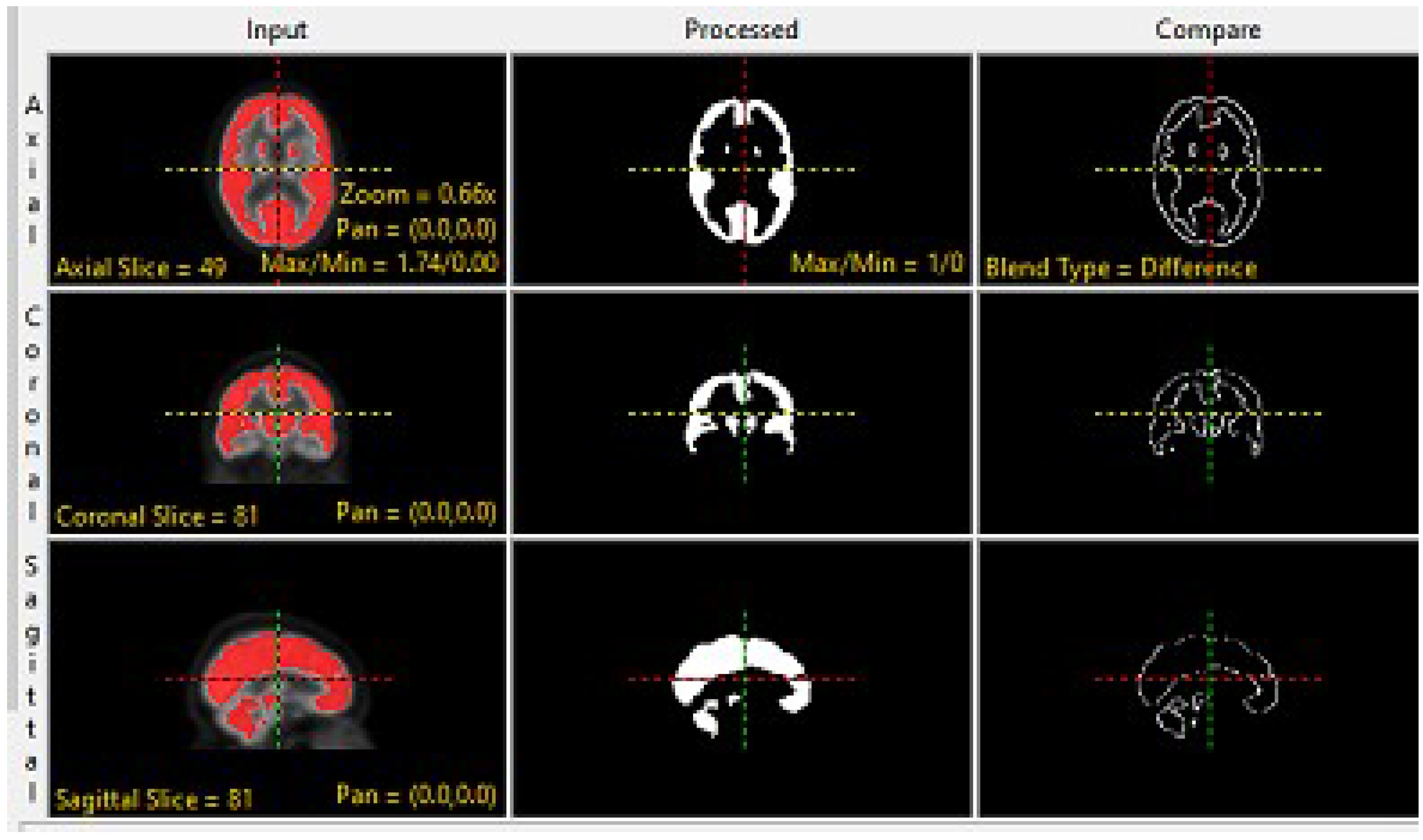Brainsci 13 01045 g003 Brainsci 13 01045 g003