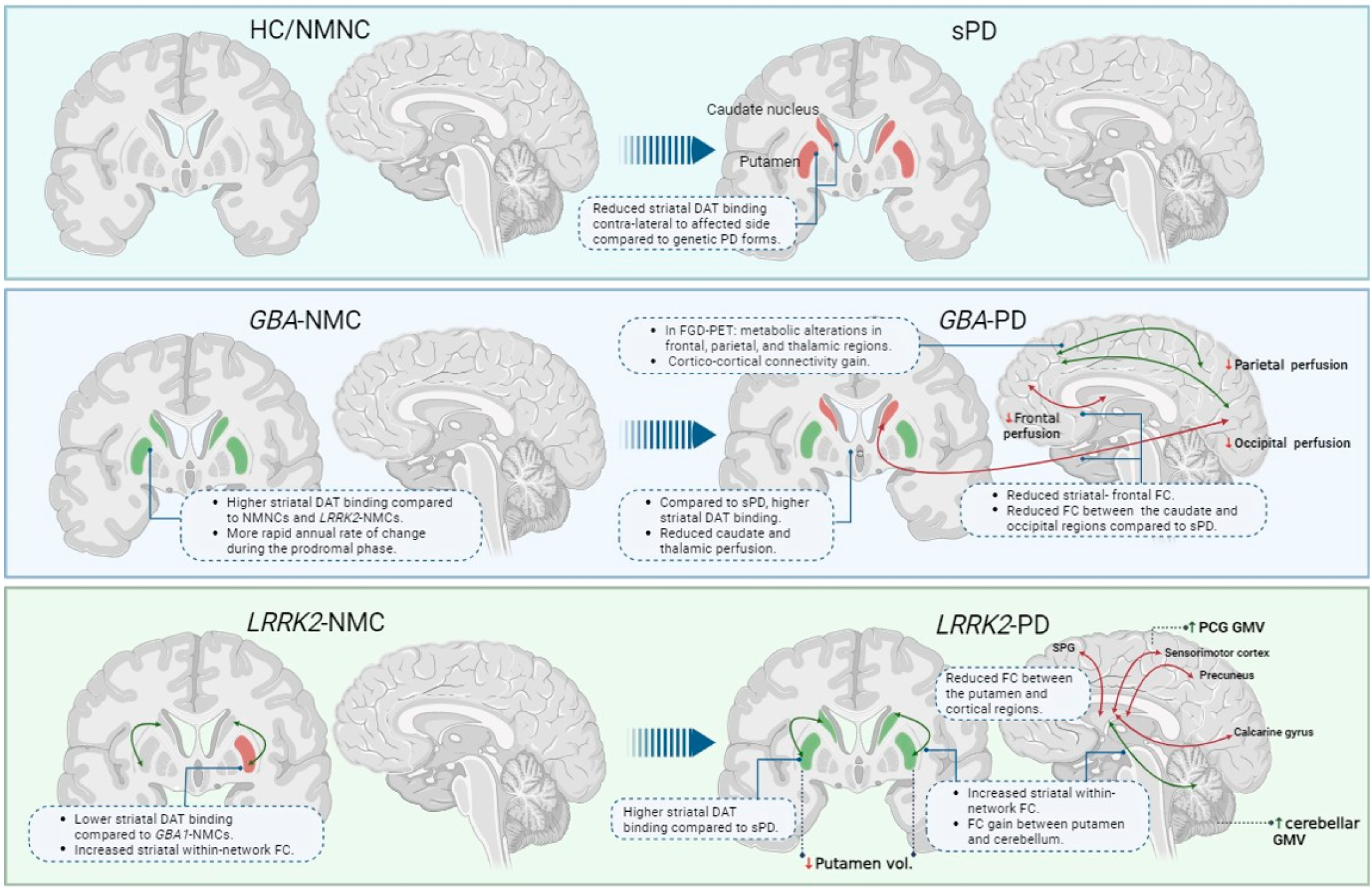 Motor Parkinson's disease and structure (Chapter 3) - Magnetic Resonance  Imaging in Movement Disorders