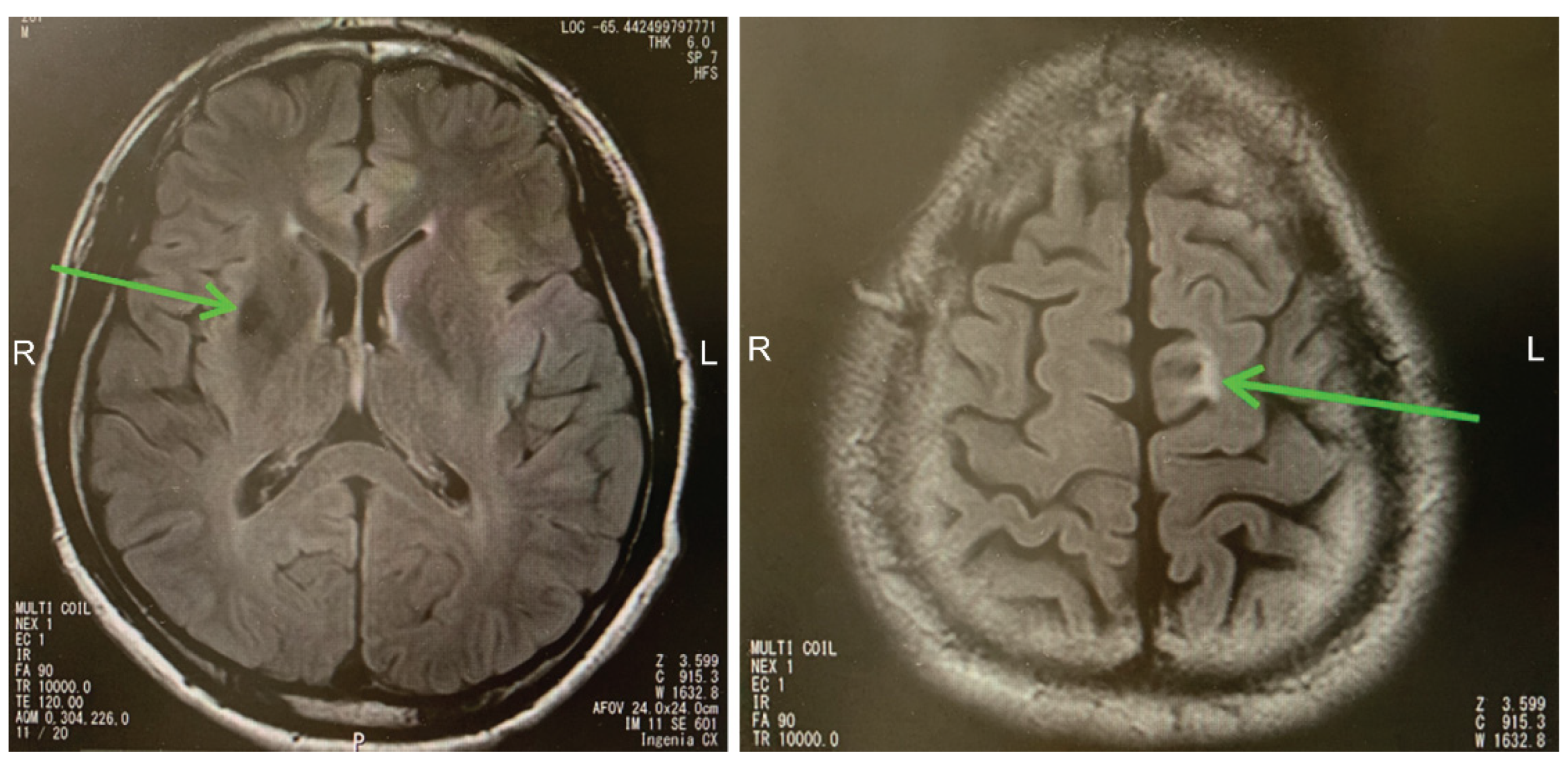 Brainsci 13 01227 g001 Brainsci 13 01227 g001