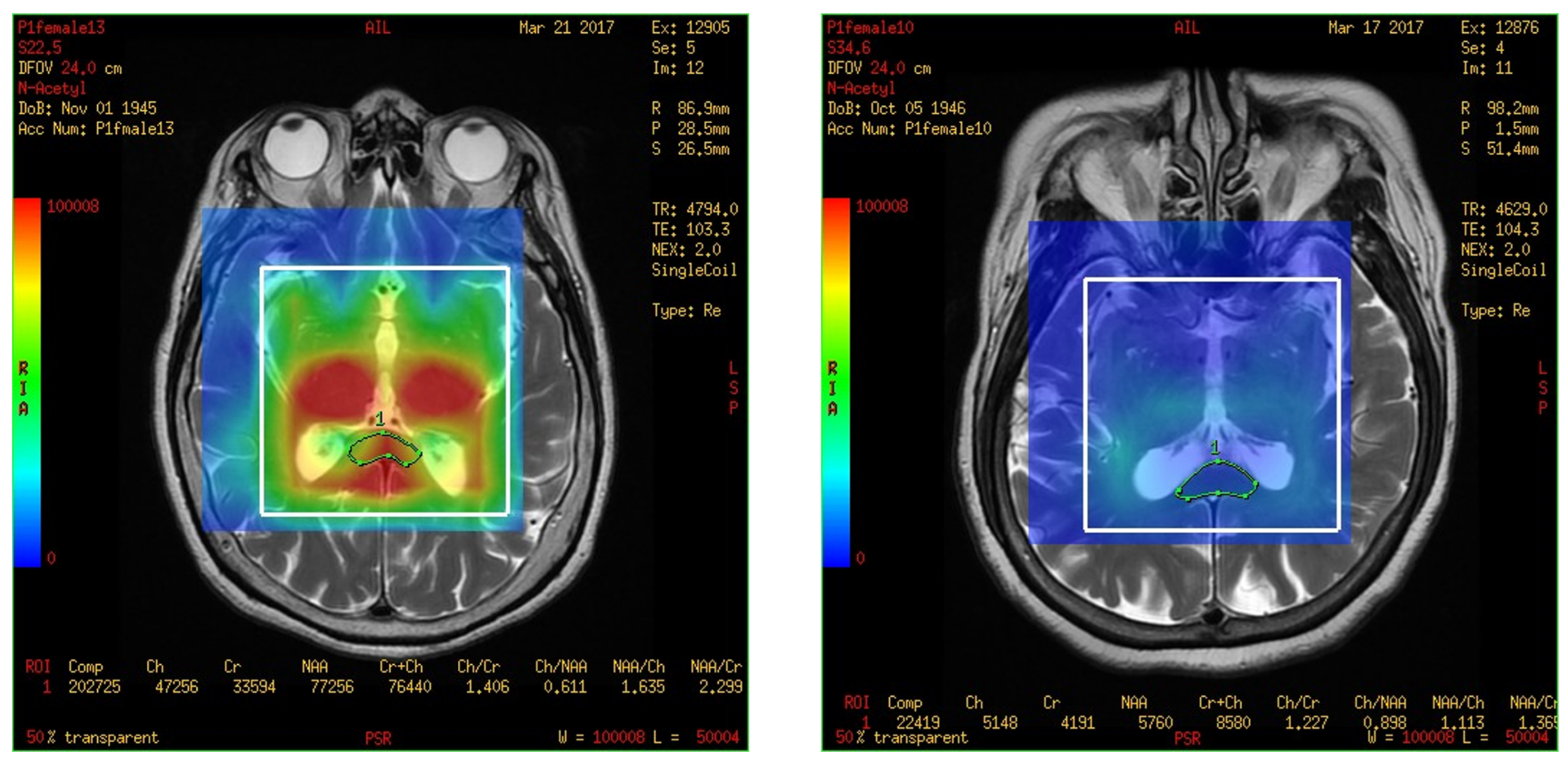 Brainsci 13 01244 g004 Brainsci 13 01244 g004