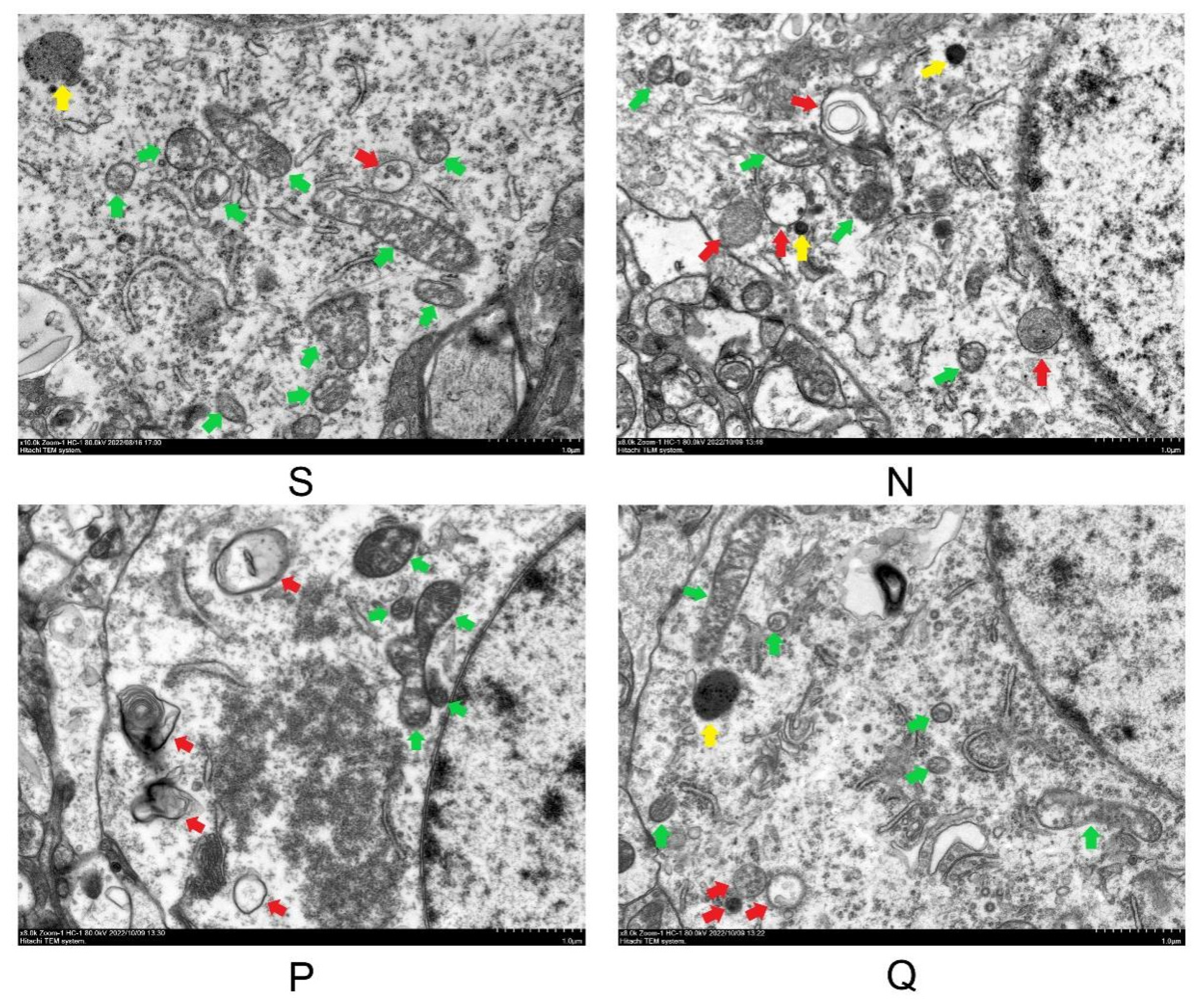 Brainsci 13 01285 g004 Brainsci 13 01285 g004