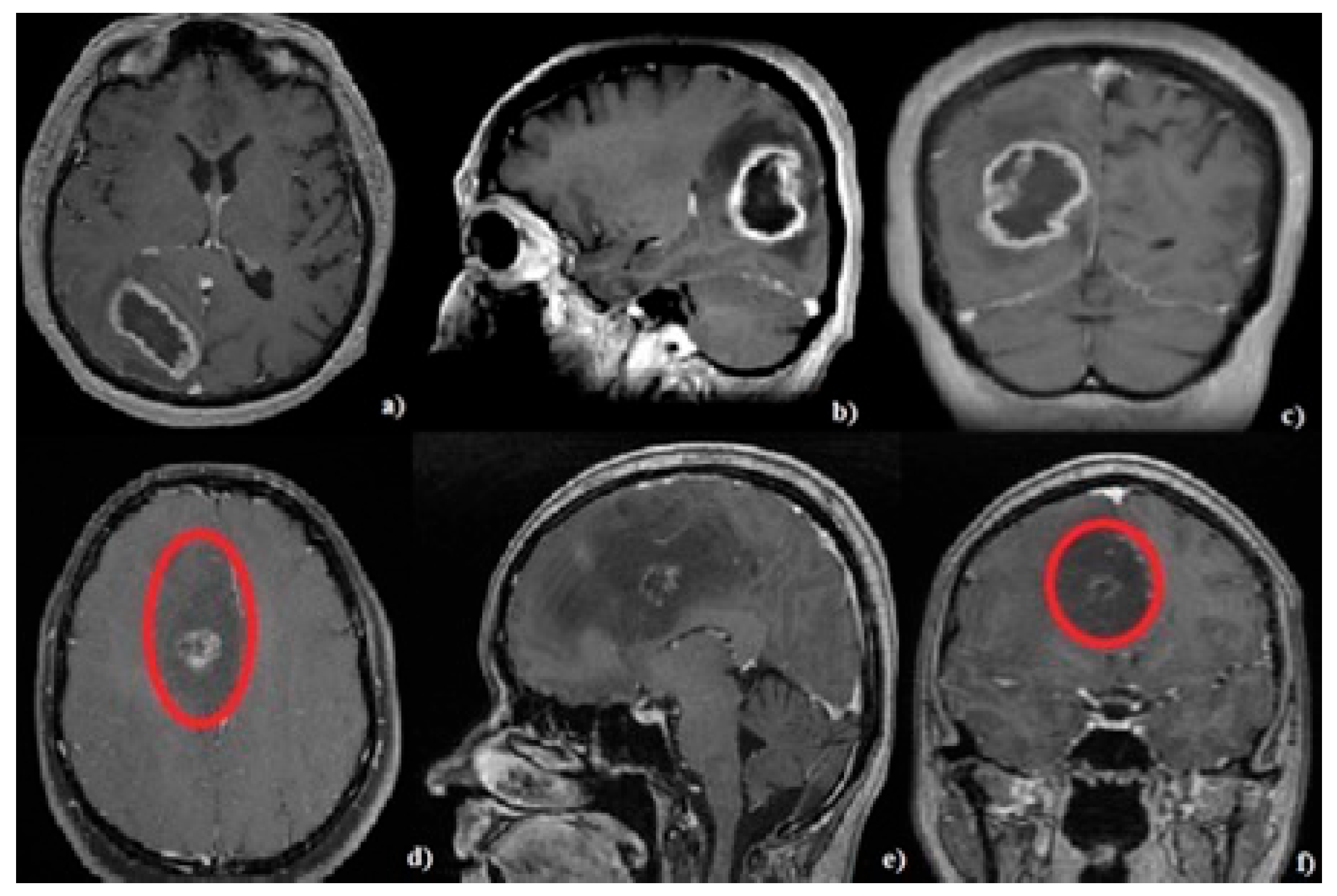 Brainsci 13 01307 g002
